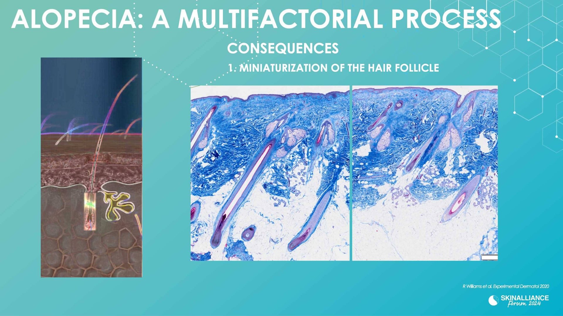 New research evidence in hair loss