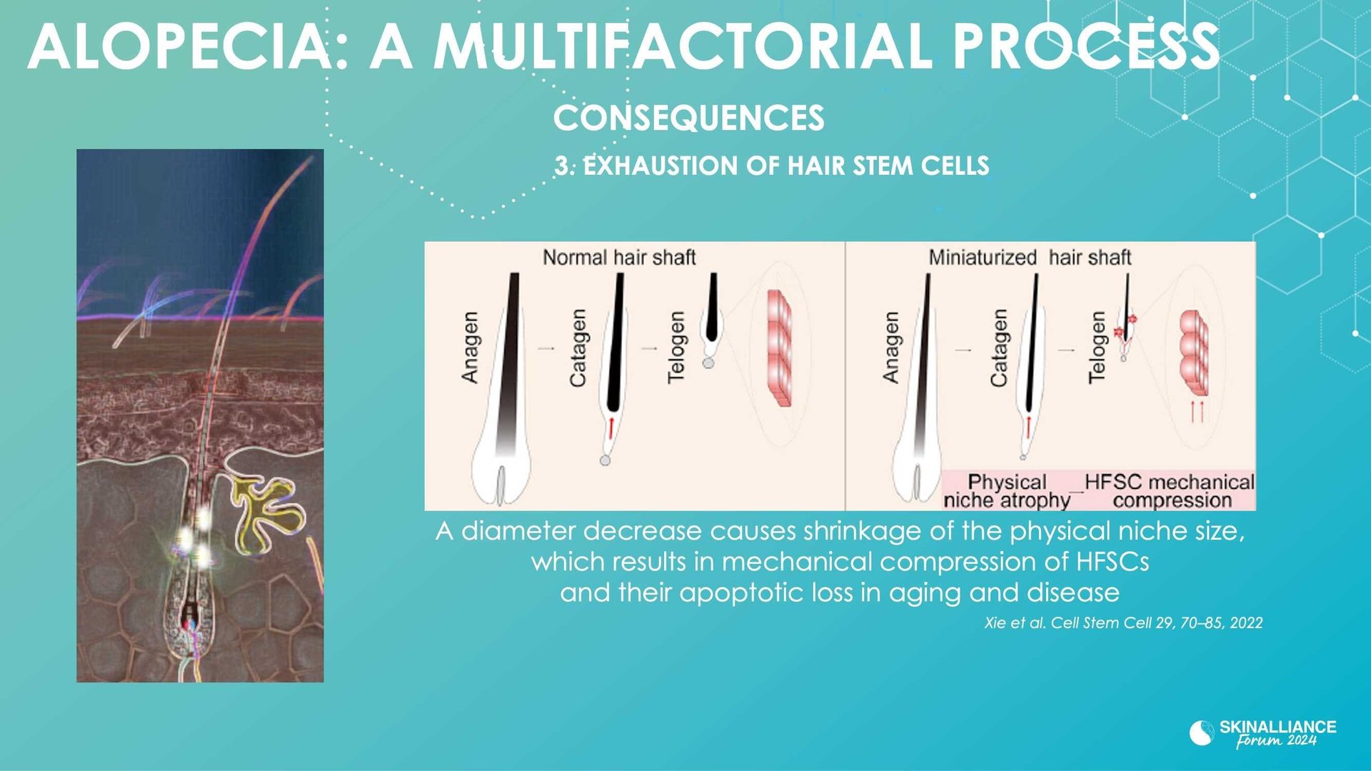New research evidence in hair loss