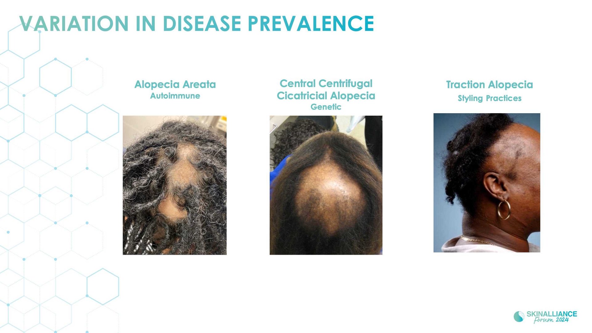 Scalp and hair diversity