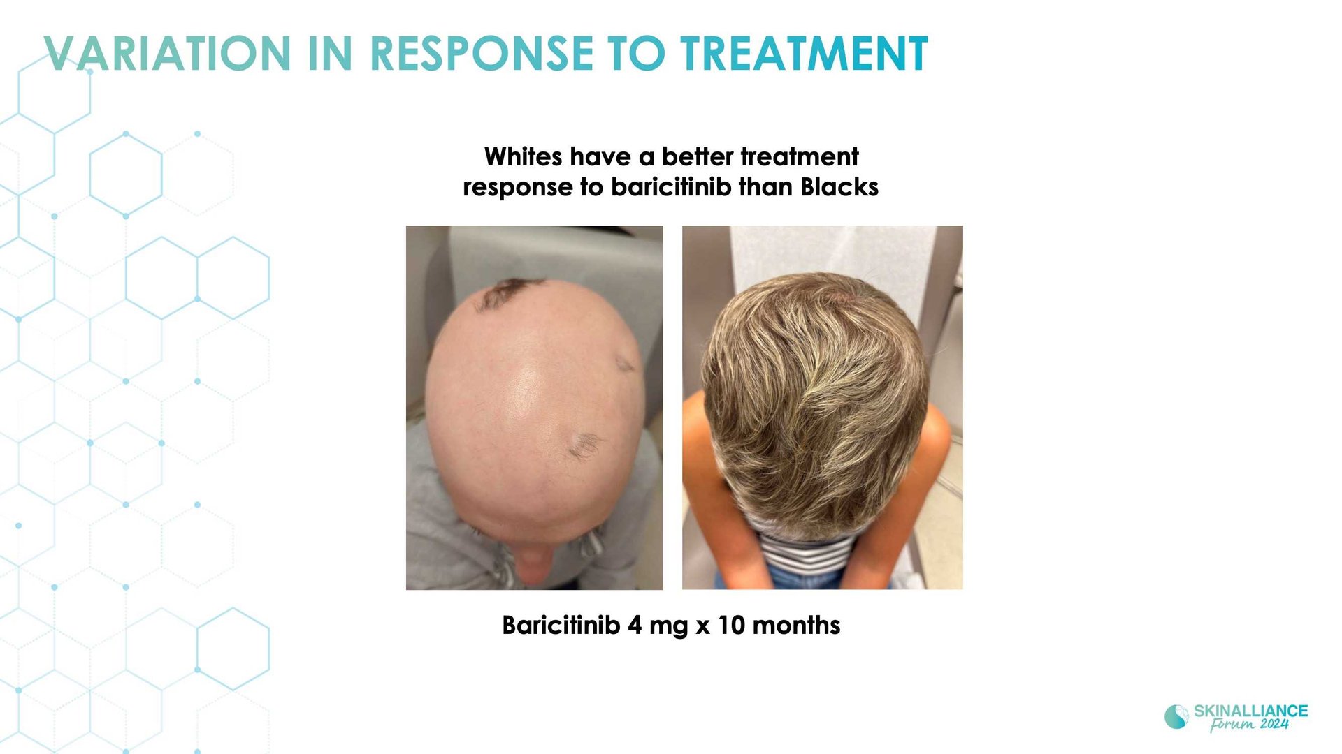 Scalp and hair diversity