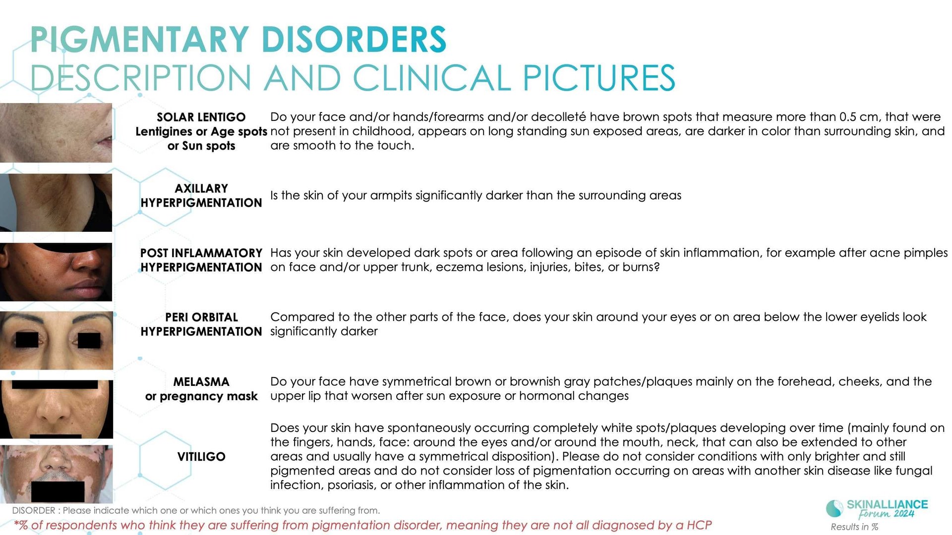 Epidemiological study of pigmentation disorders and impact on QOL and stigmatisation