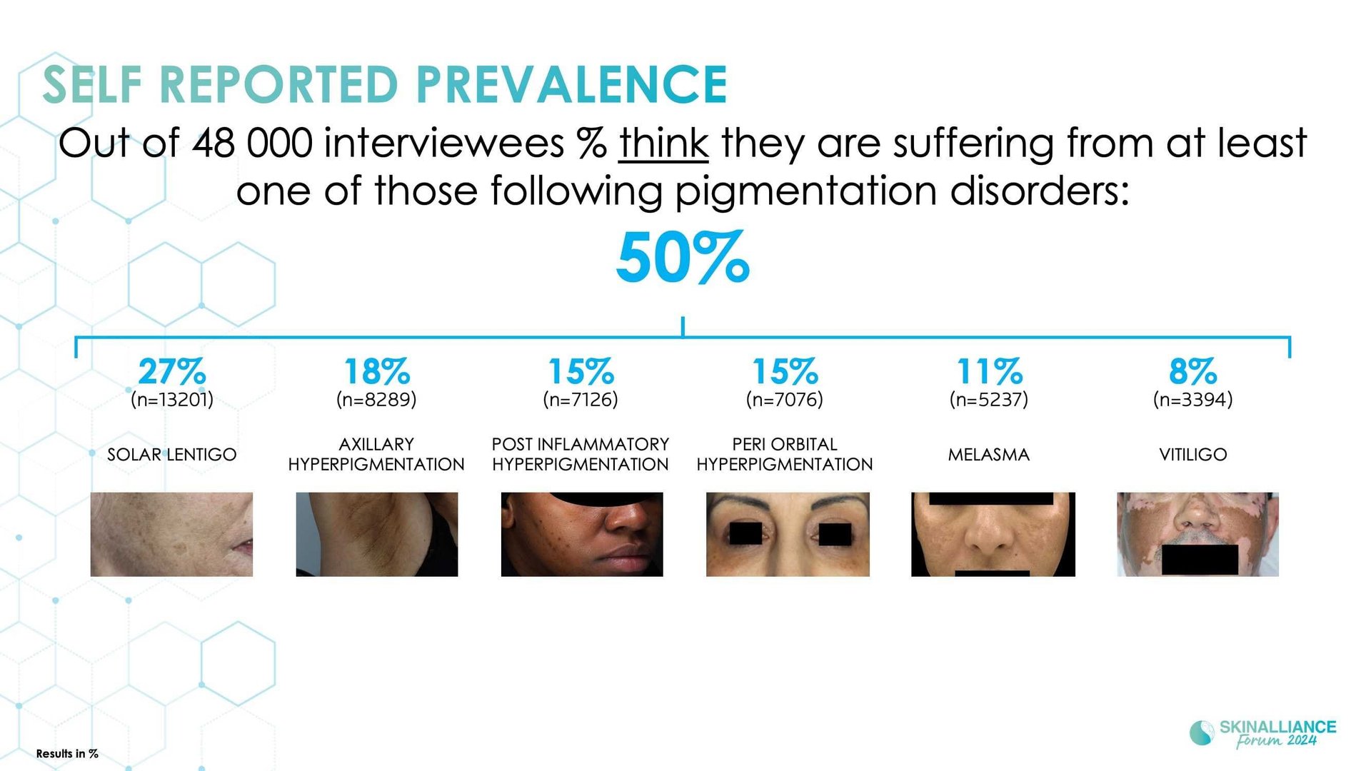 Epidemiological study of pigmentation disorders and impact on QOL and stigmatisation