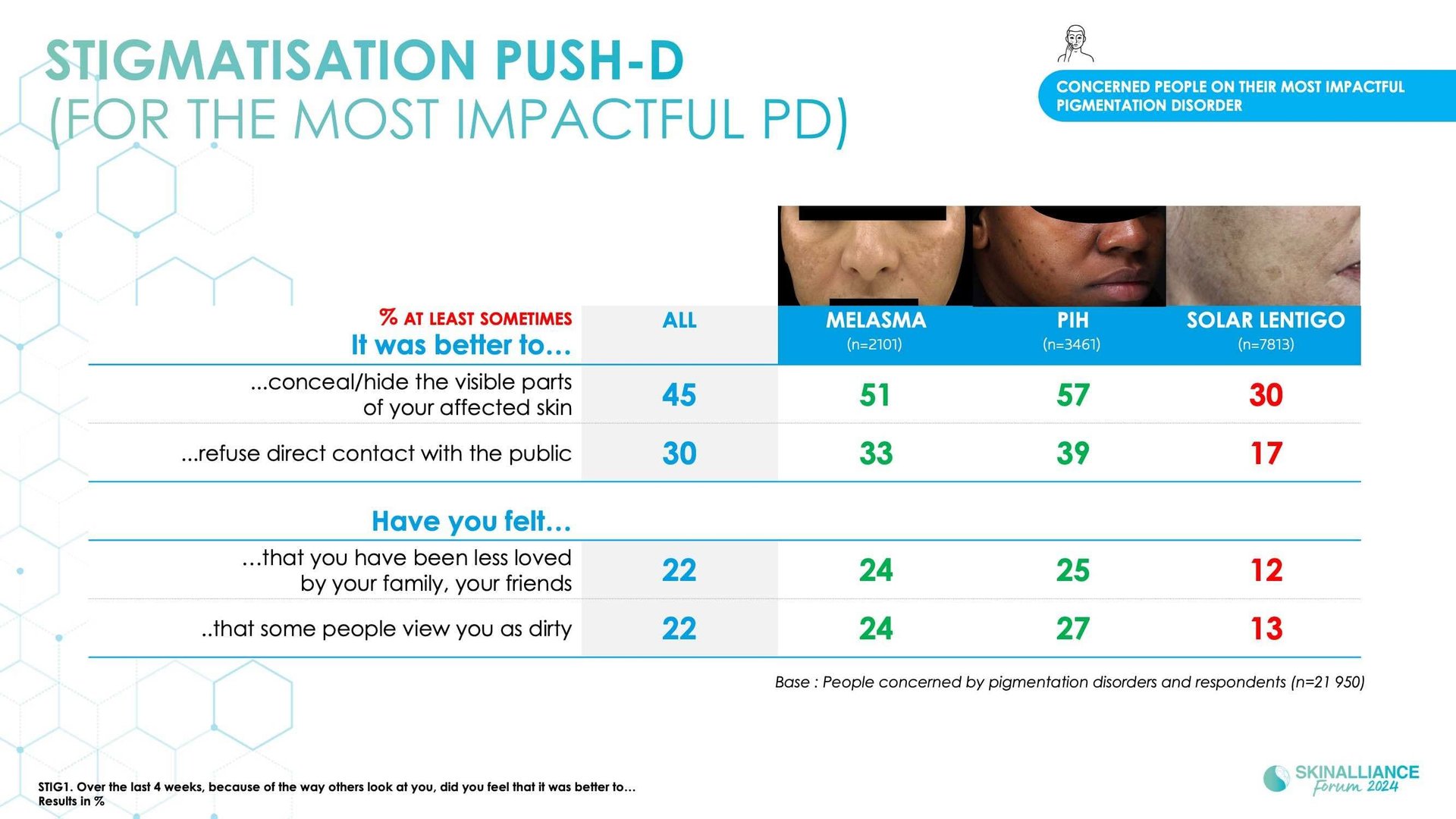 Epidemiological study of pigmentation disorders and impact on QOL and stigmatisation