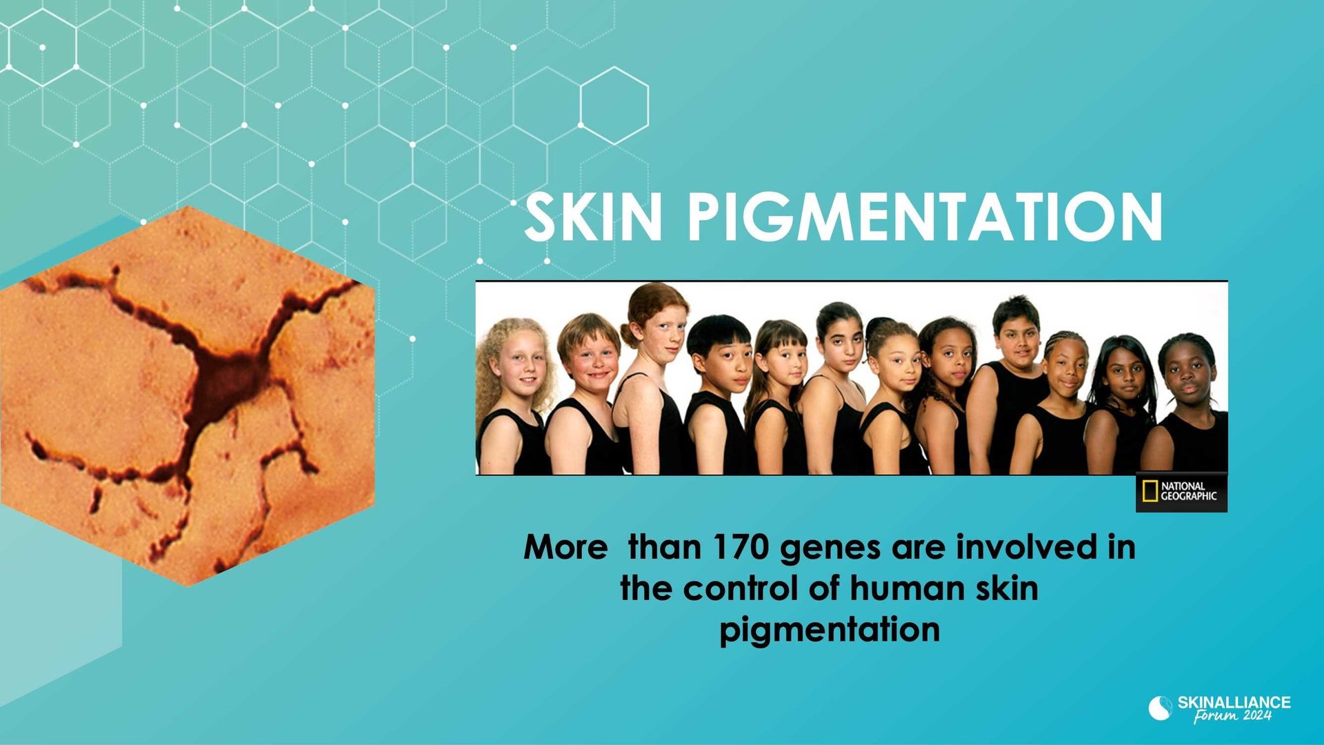 New insights in the physiopathology of hyperpigmentation and clinical impact