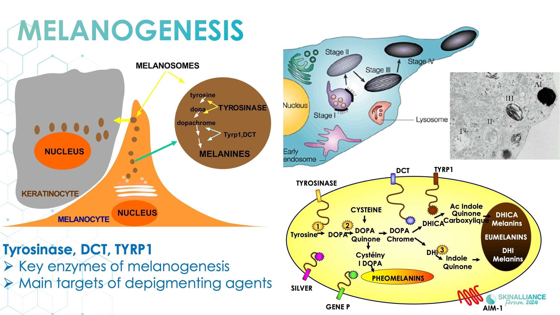 New insights in the physiopathology of hyperpigmentation and clinical impact