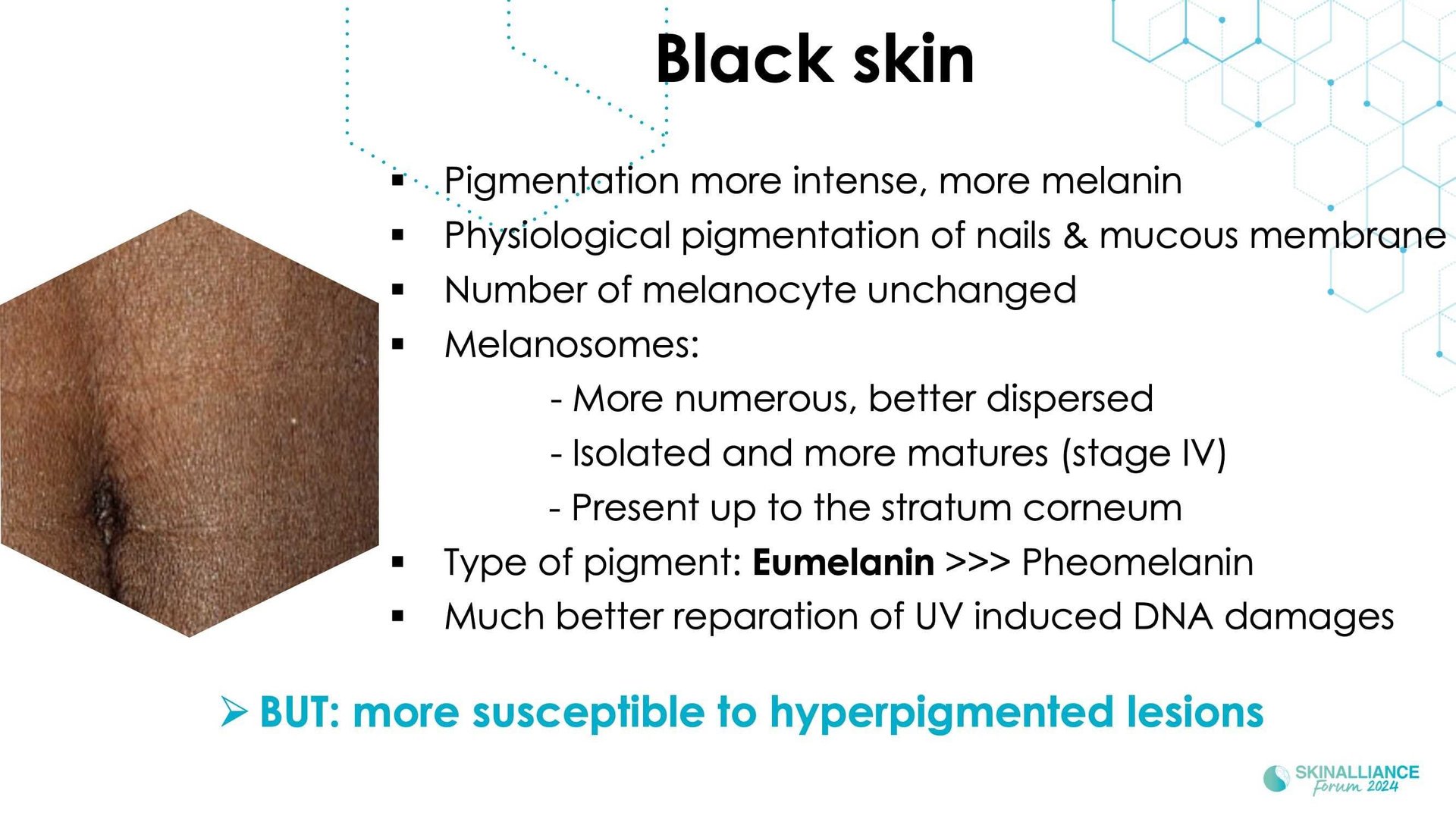 New insights in the physiopathology of hyperpigmentation and clinical impact