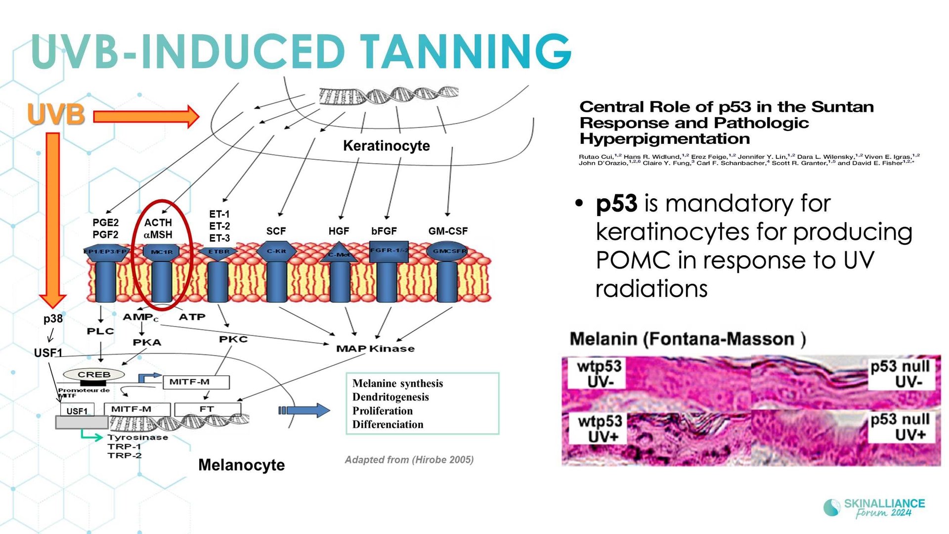 New insights in the physiopathology of hyperpigmentation and clinical impact