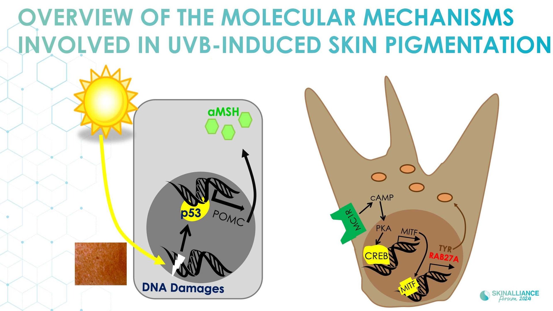 New insights in the physiopathology of hyperpigmentation and clinical impact