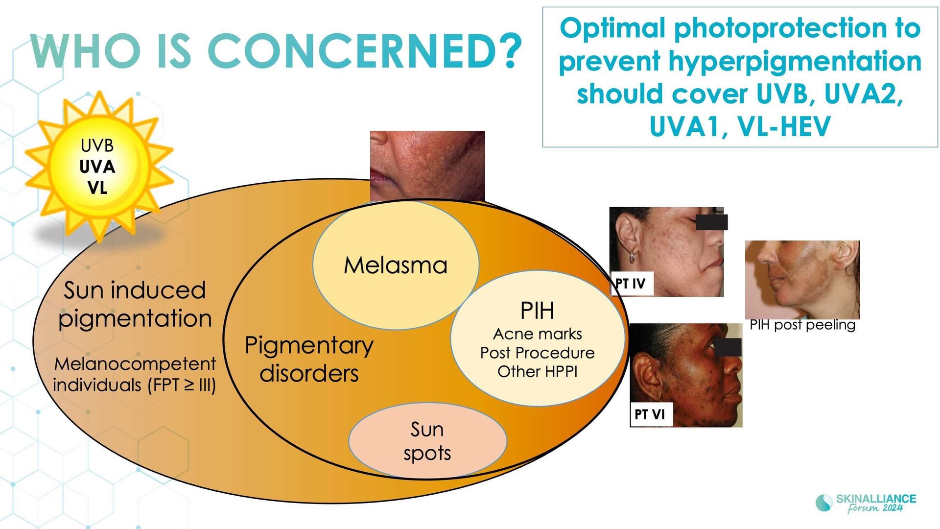 New insights in the physiopathology of hyperpigmentation and clinical impact