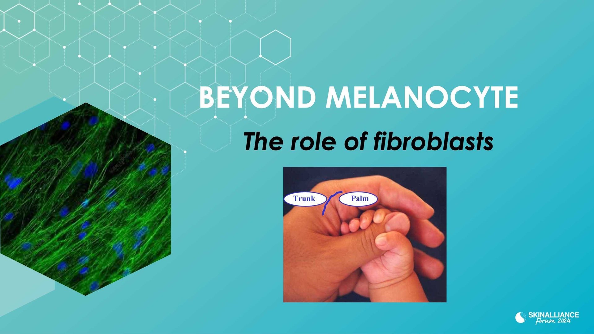 New insights in the physiopathology of hyperpigmentation and clinical impact