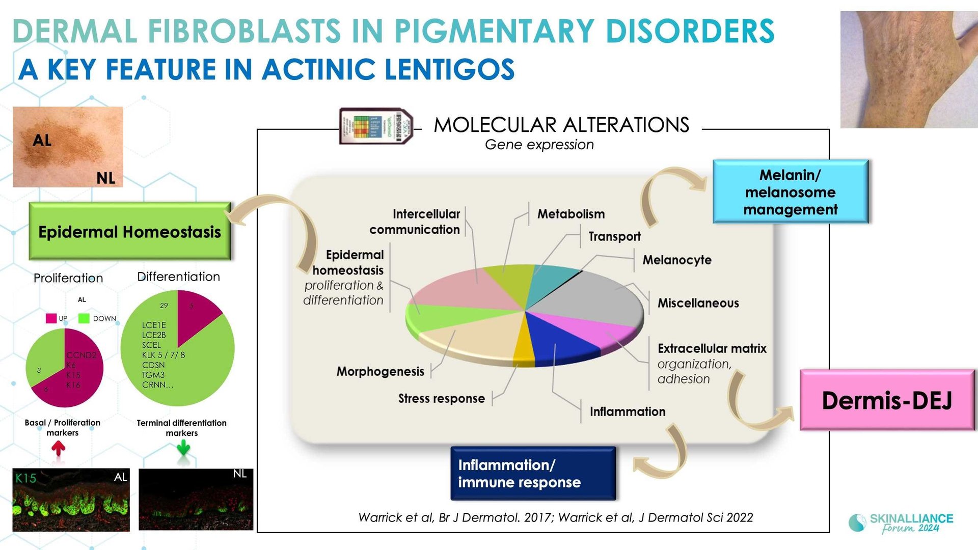 New insights in the physiopathology of hyperpigmentation and clinical impact