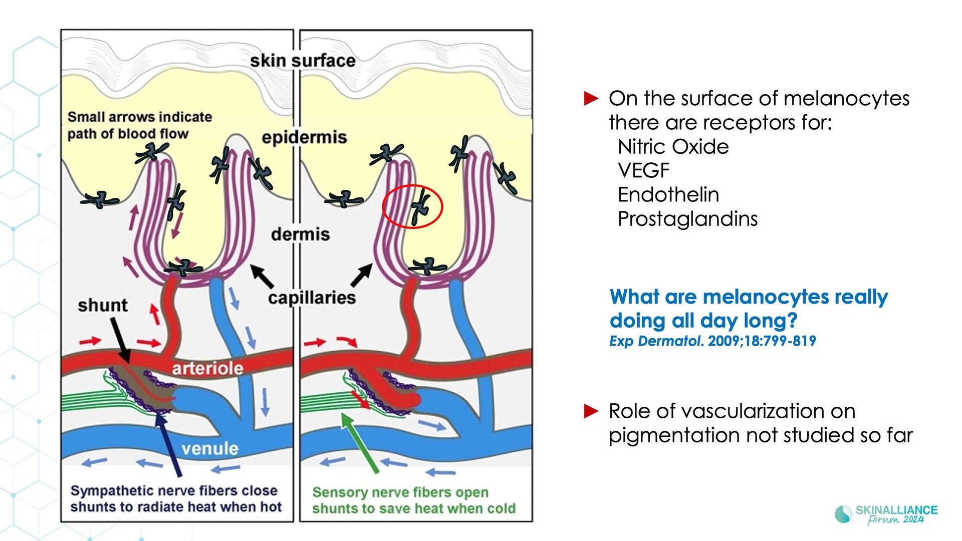New insights in the physiopathology of hyperpigmentation and clinical impact