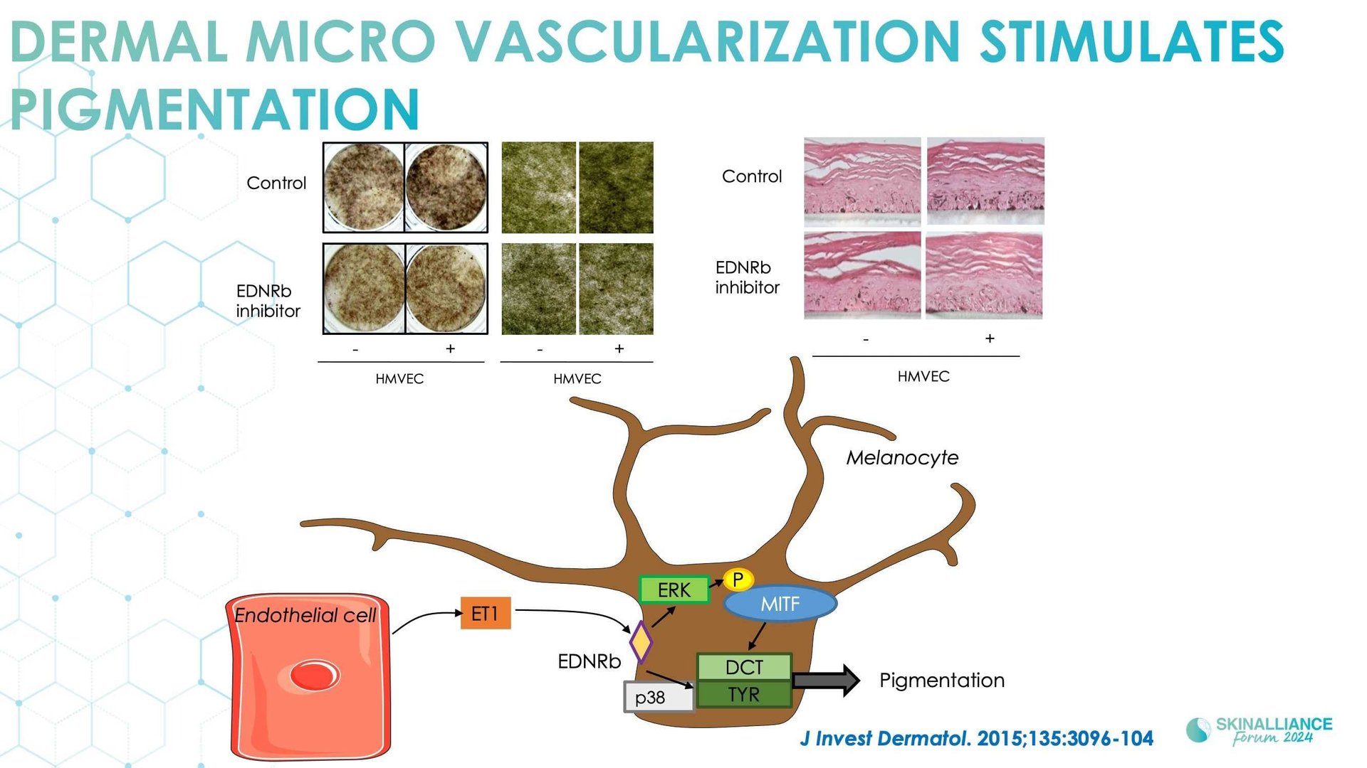 New insights in the physiopathology of hyperpigmentation and clinical impact