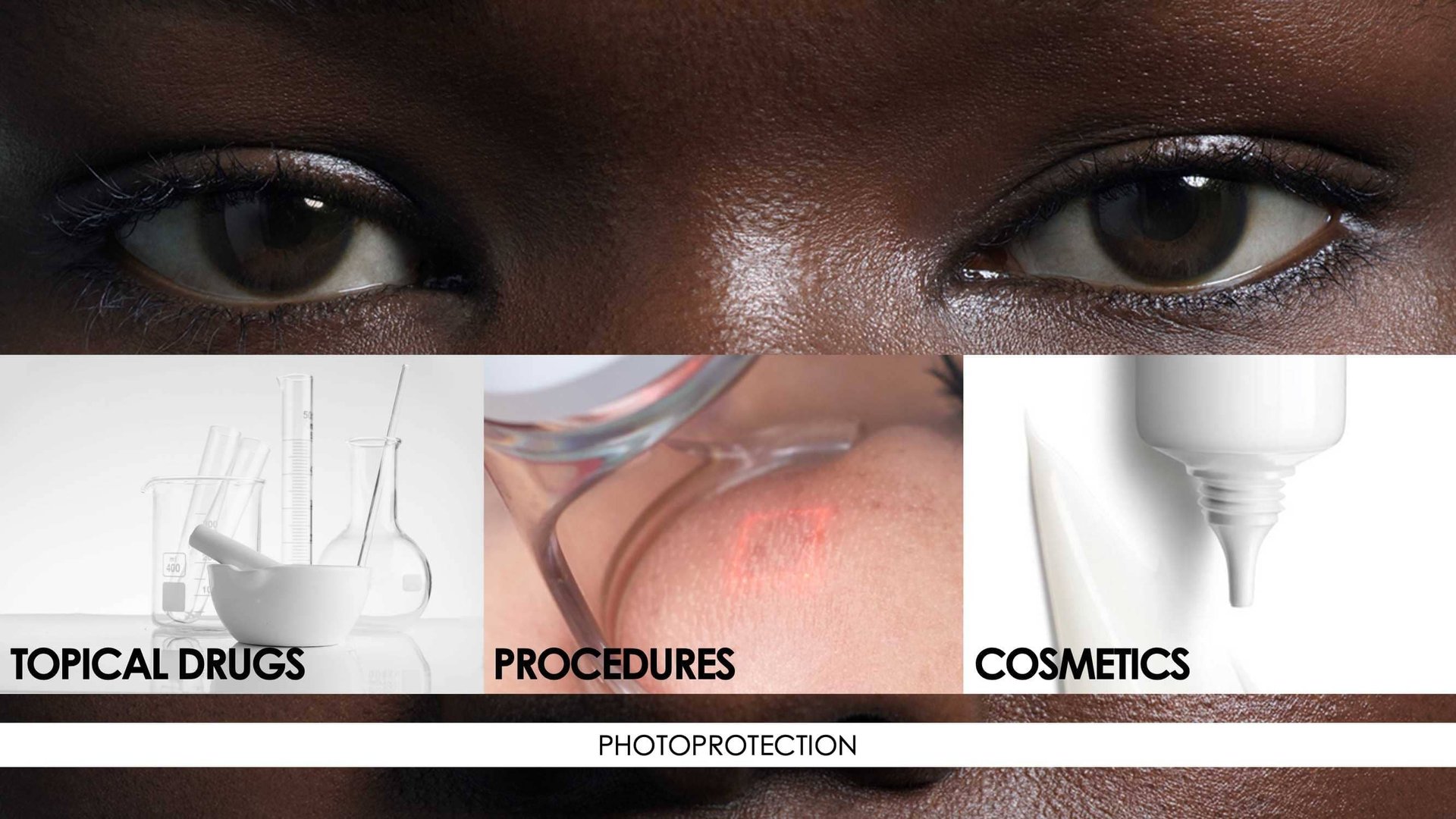 New topical agent for hyperpigmentation management