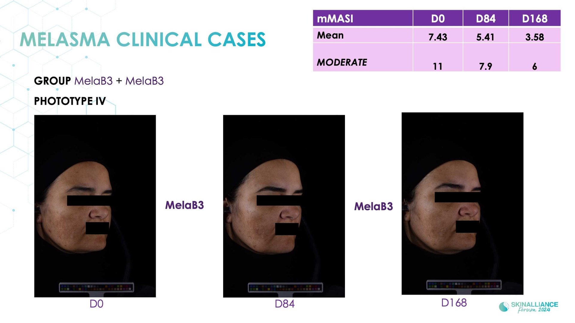 New topical agent for hyperpigmentation management