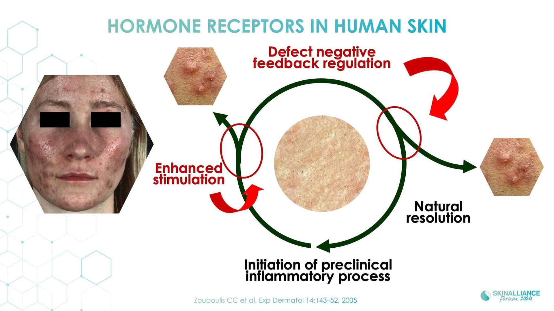 Skin conditions variations related to women's hormonal changes