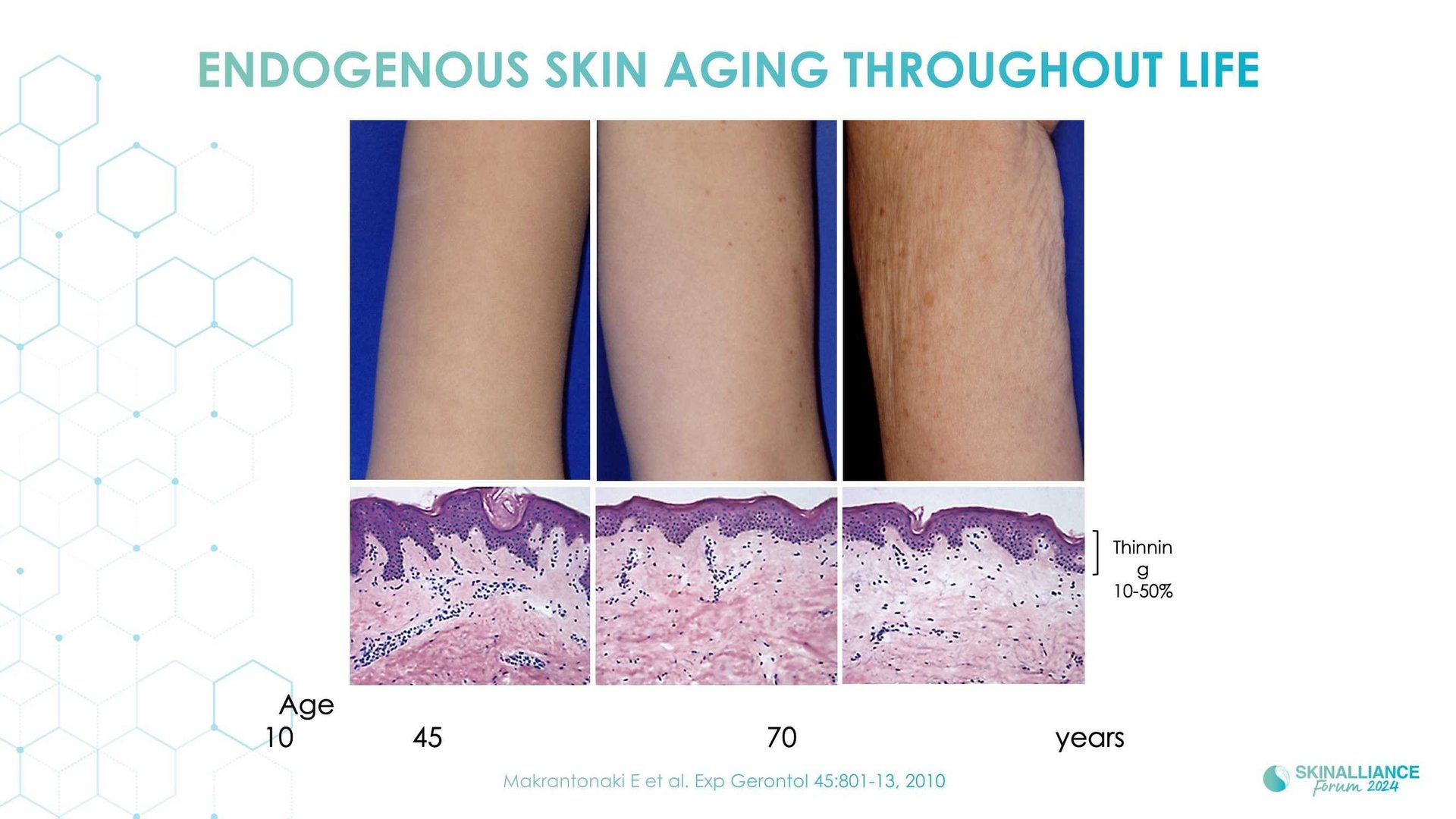 Skin conditions variations related to women's hormonal changes