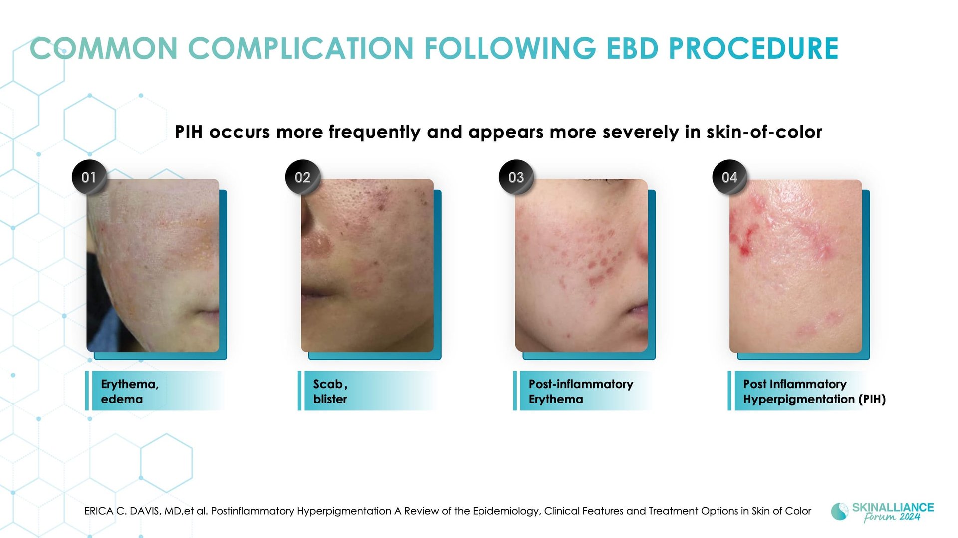 Capture aesthetic trend with integrated skincare solutions in Asian skin