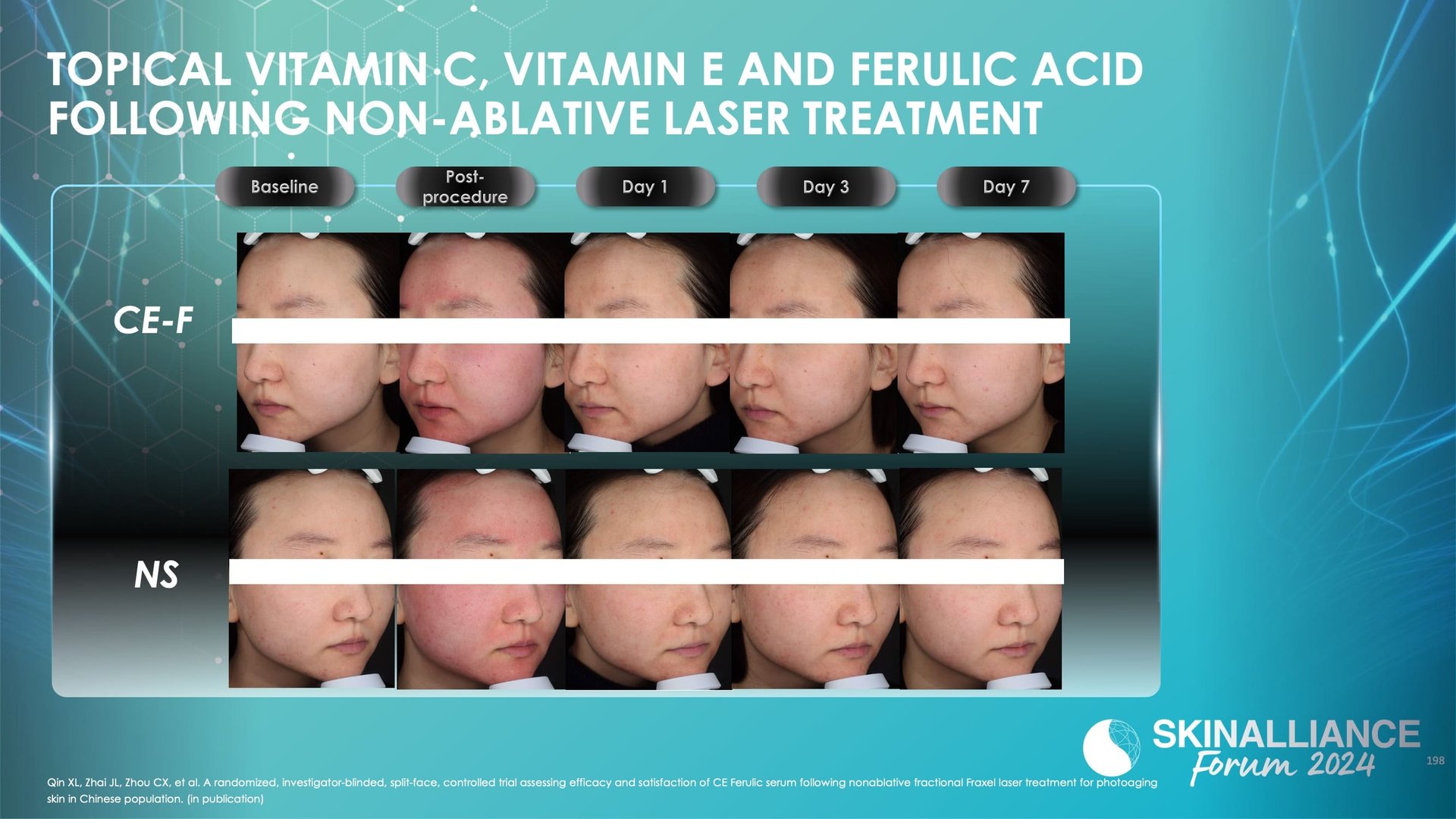 Capture aesthetic trend with integrated skincare solutions in Asian skin