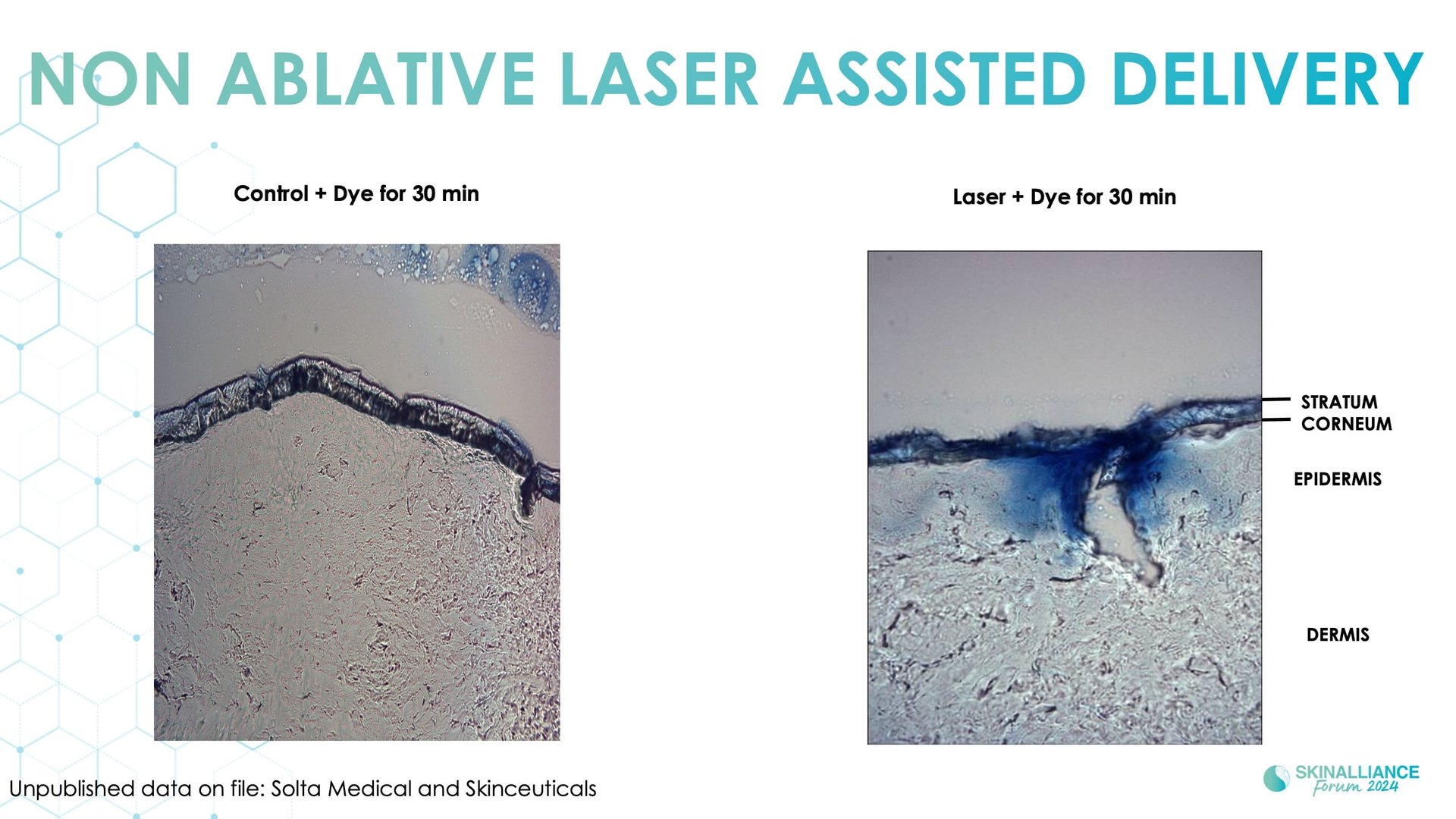 Integrating skincare for managing patient satisfaction with energy-based dermatologic procedures