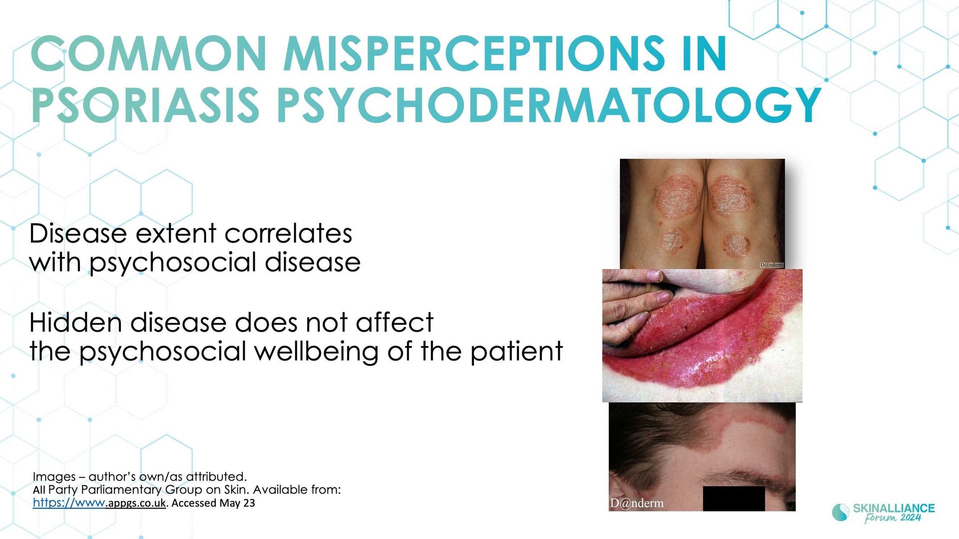 KEYNOTE: The importance of patients' mental health in dermatology practice