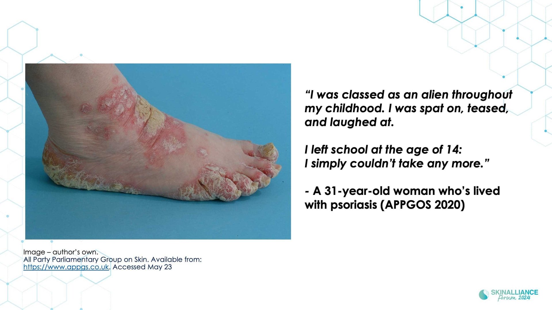 KEYNOTE: The importance of patients' mental health in dermatology practice