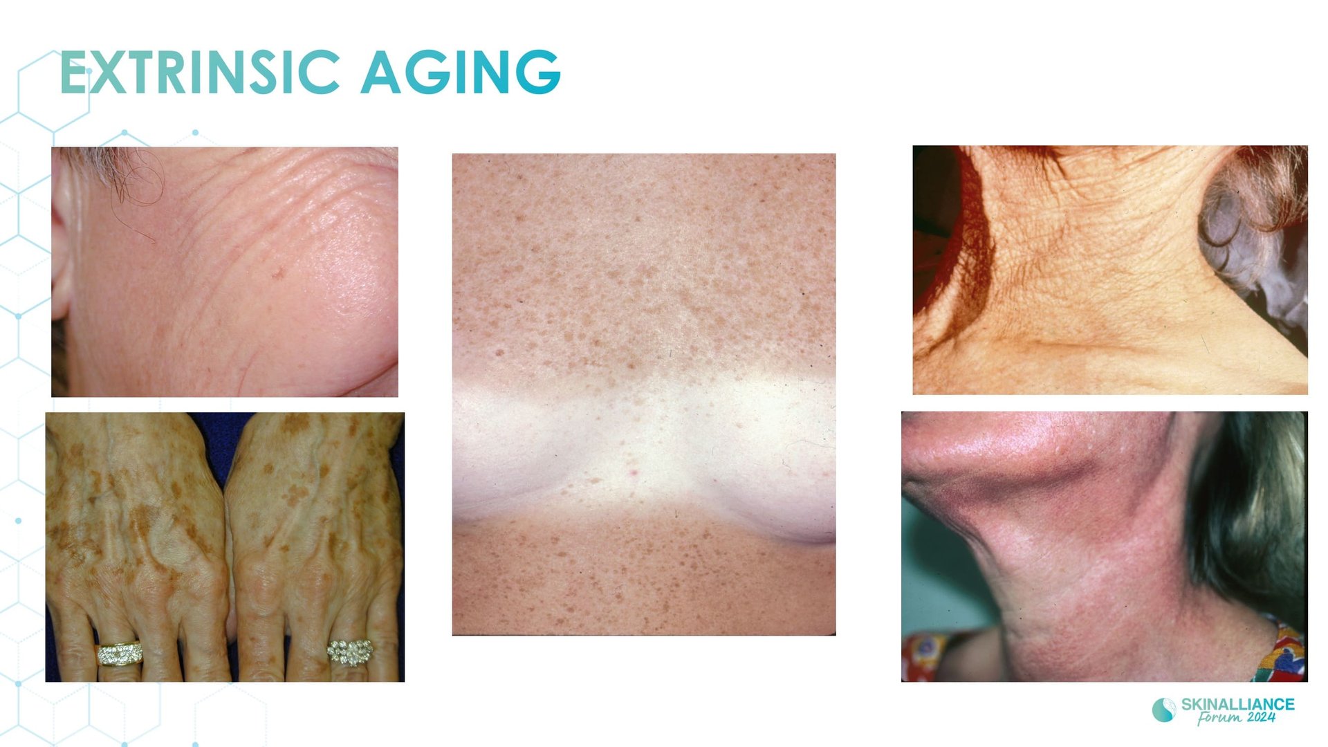 Topical antioxidant ingredients
