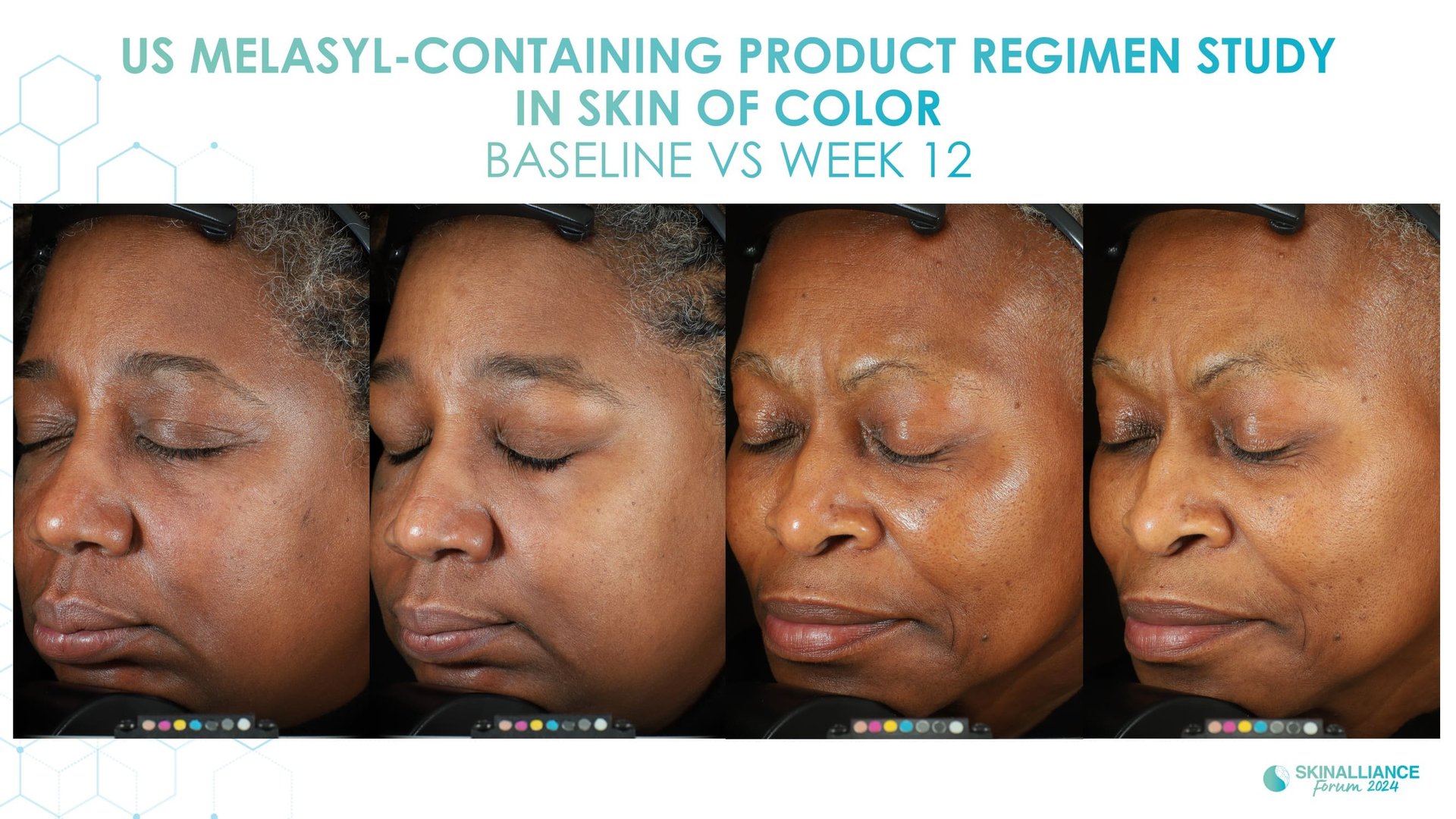 Discoloration ingredients
