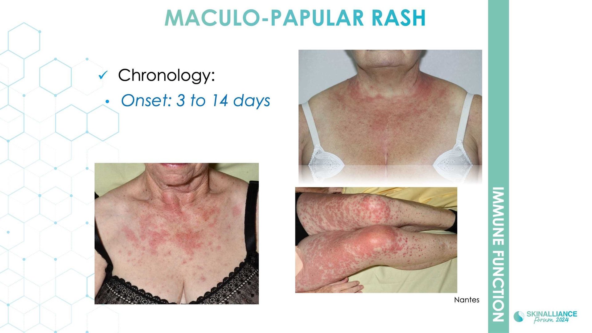 Anticancer-related skin toxicities management of adverse event