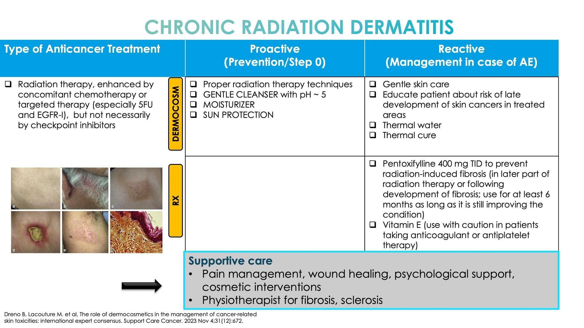 Anticancer-related skin toxicities management of adverse event