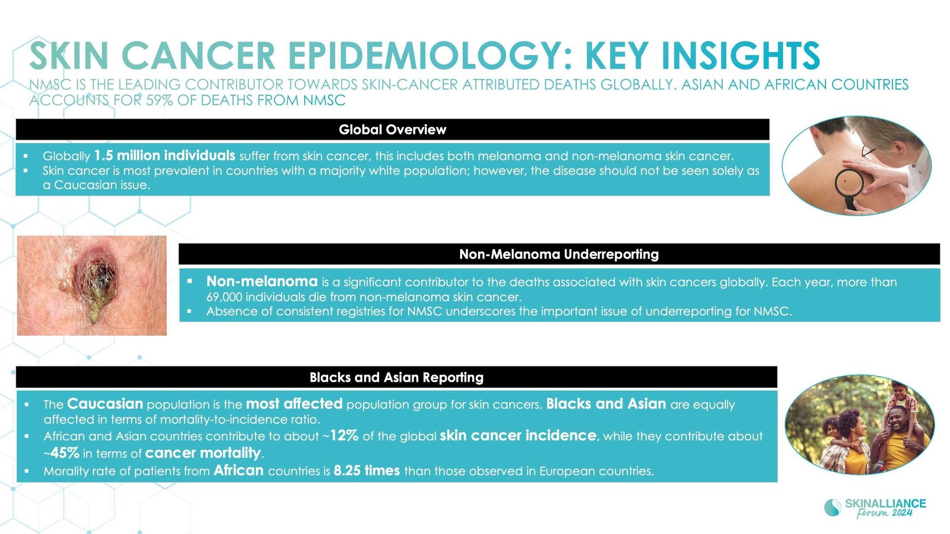 A new light on skin cancer incidence and mortality rates