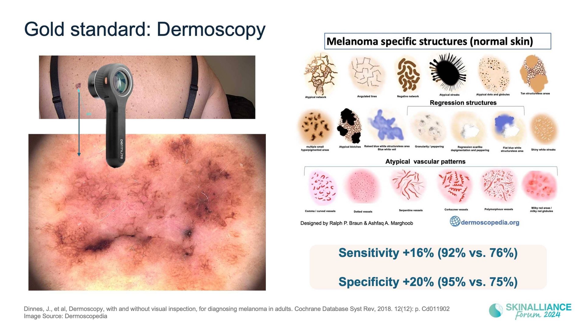 Overview of skin cancer detection devices using artificial intelligence