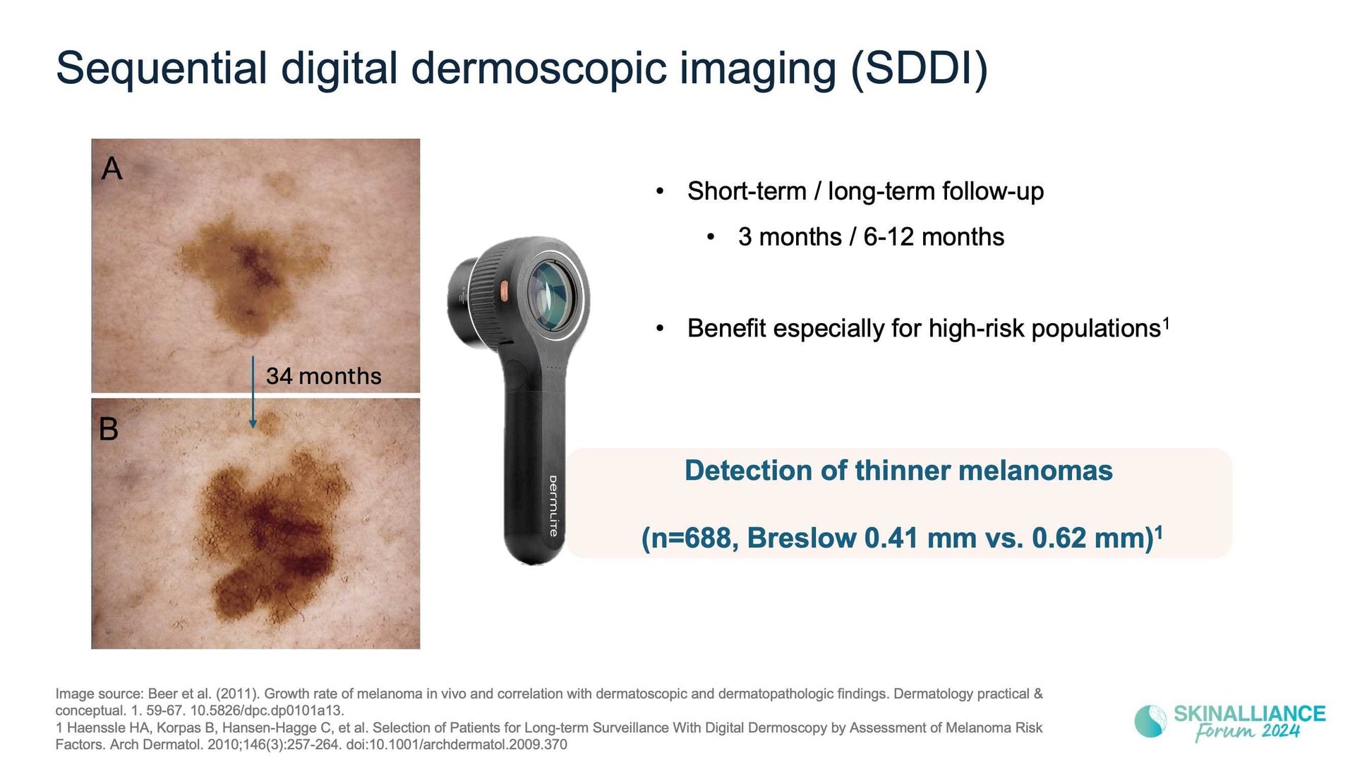Overview of skin cancer detection devices using artificial intelligence