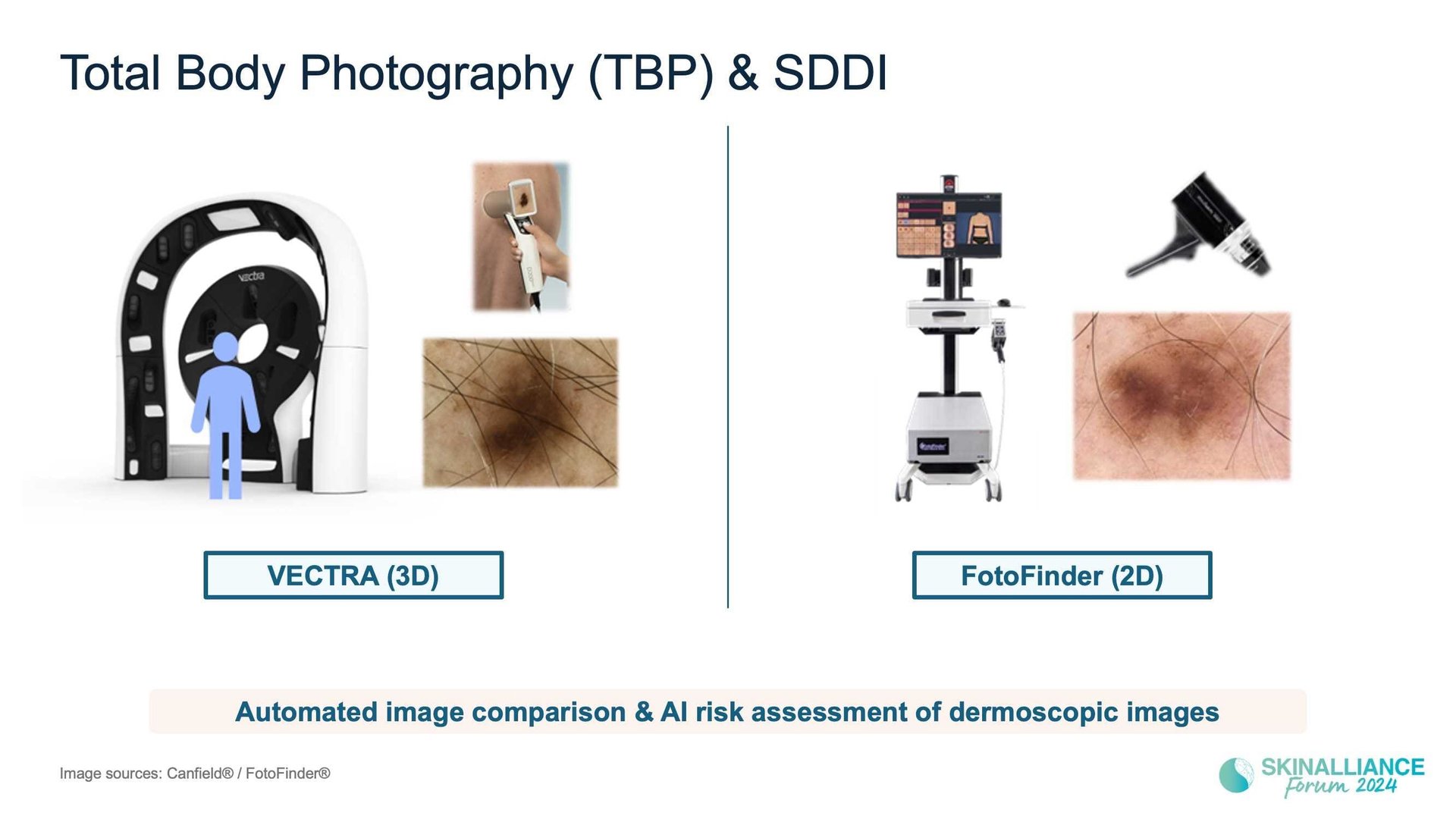 Overview of skin cancer detection devices using artificial intelligence