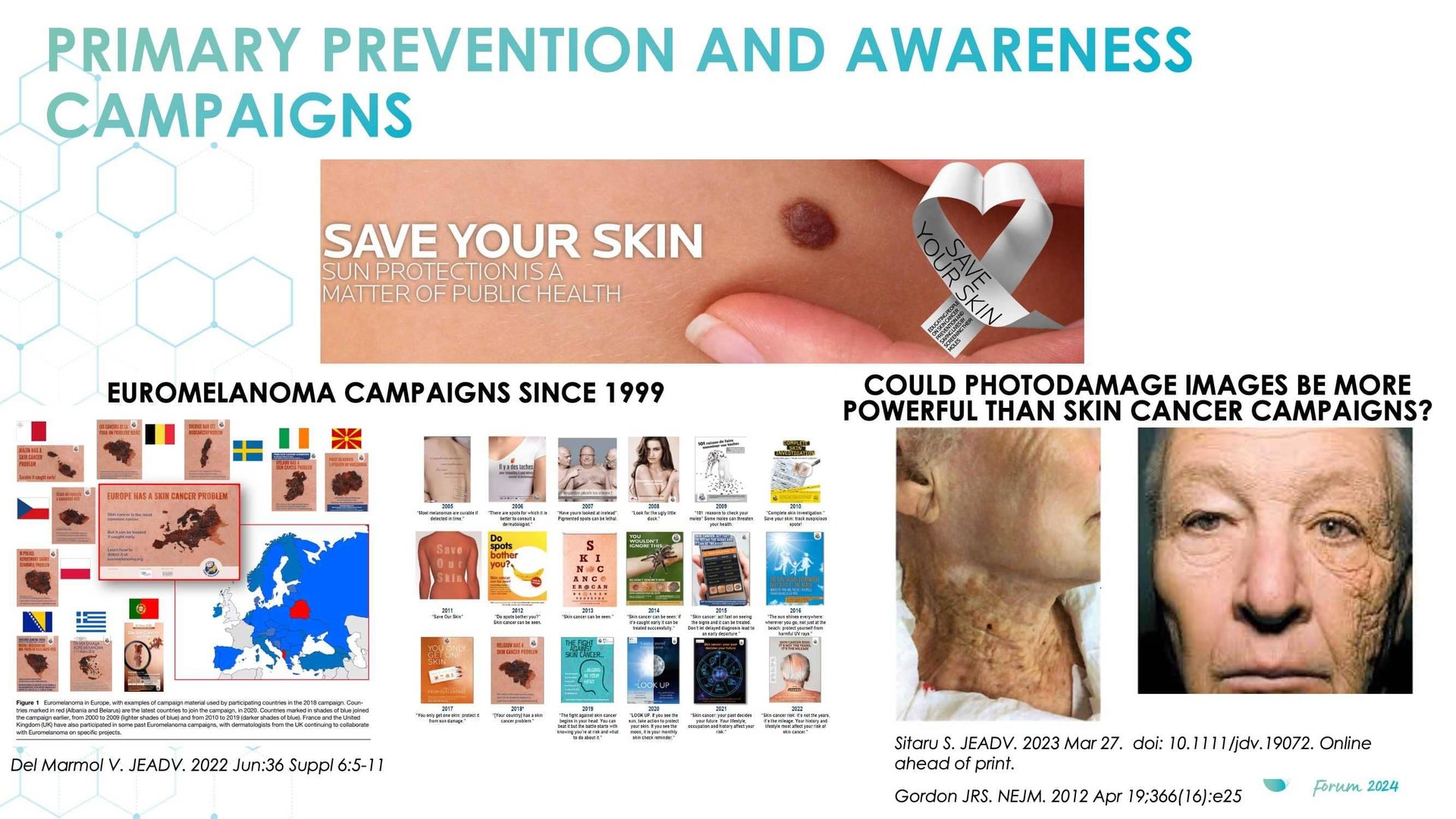 Overview of skin cancer detection devices using artificial intelligence