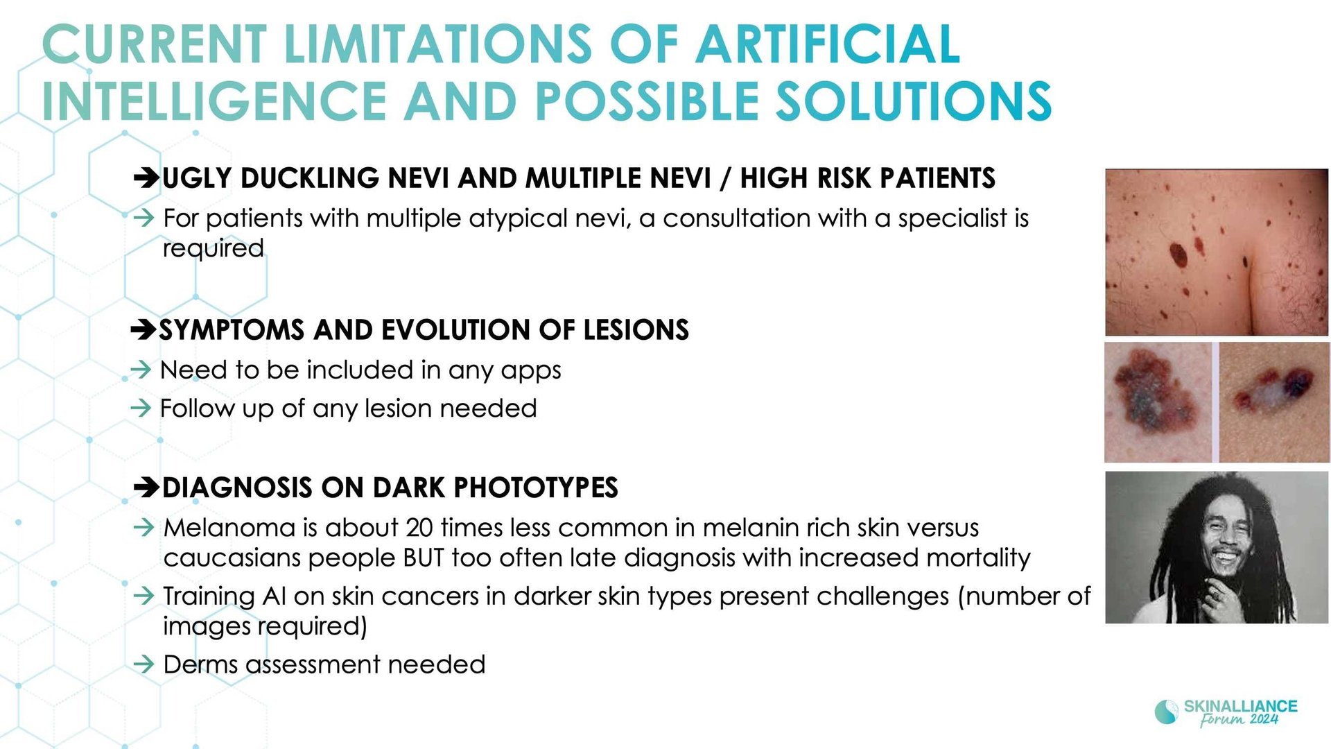 Overview of skin cancer detection devices using artificial intelligence