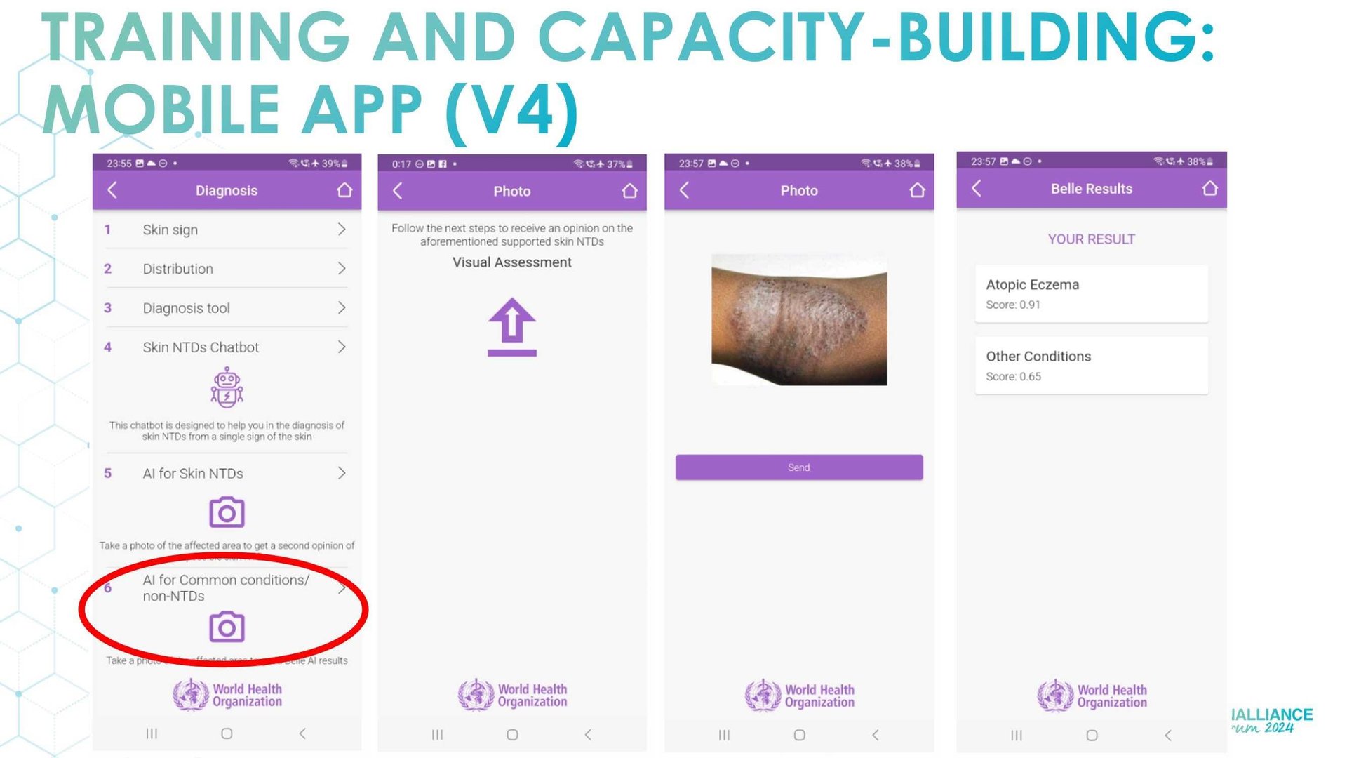 WHO initiatives to support skin health access