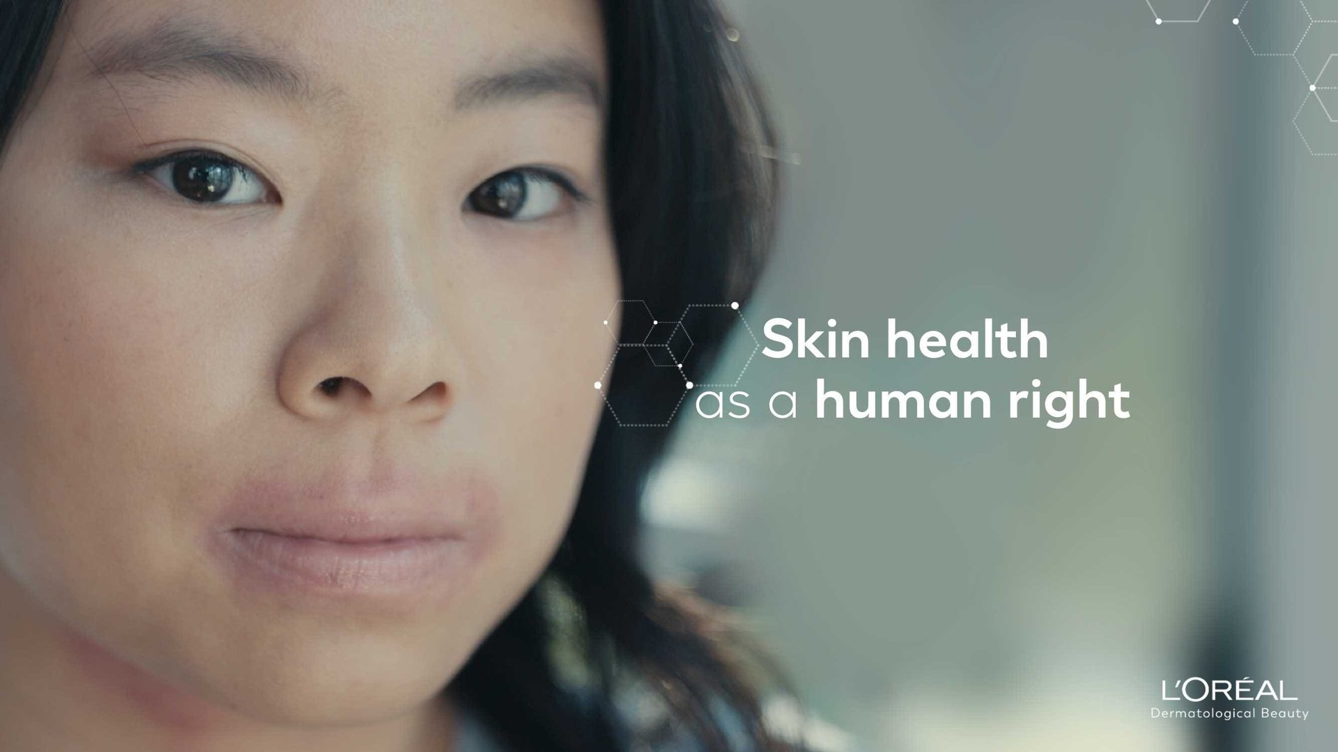 L'Oréal initiatives to support skin health access
