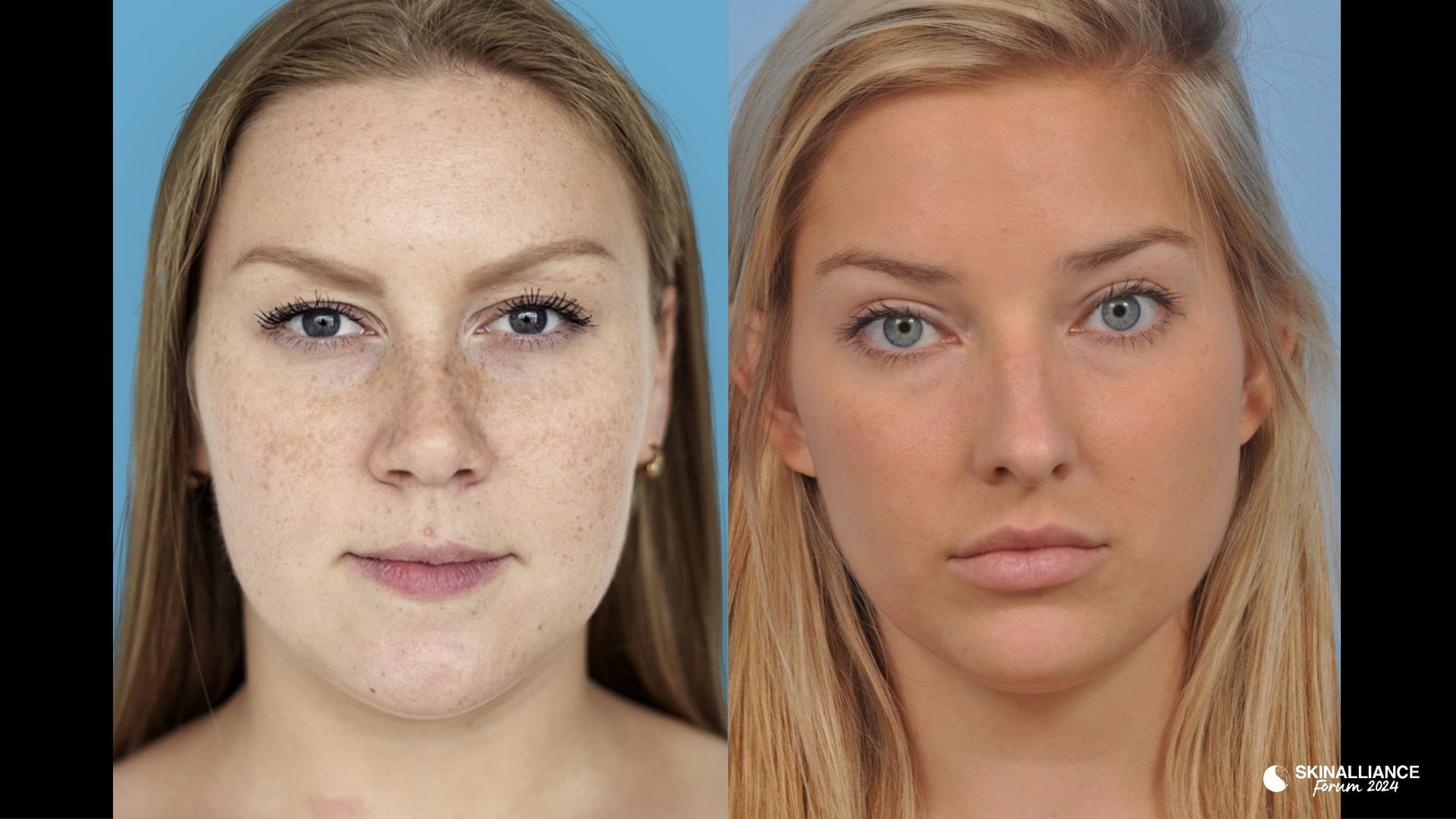 KEYNOTE: What is Beauty? Defining an enigma in the scientific age