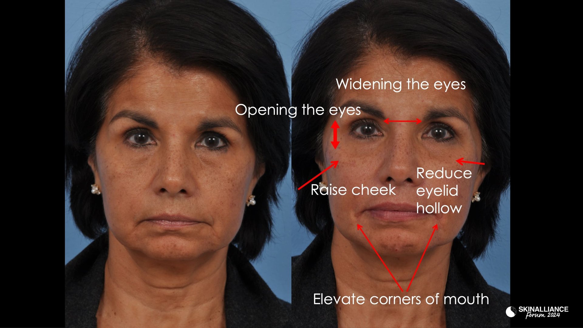 KEYNOTE: What is Beauty? Defining an enigma in the scientific age