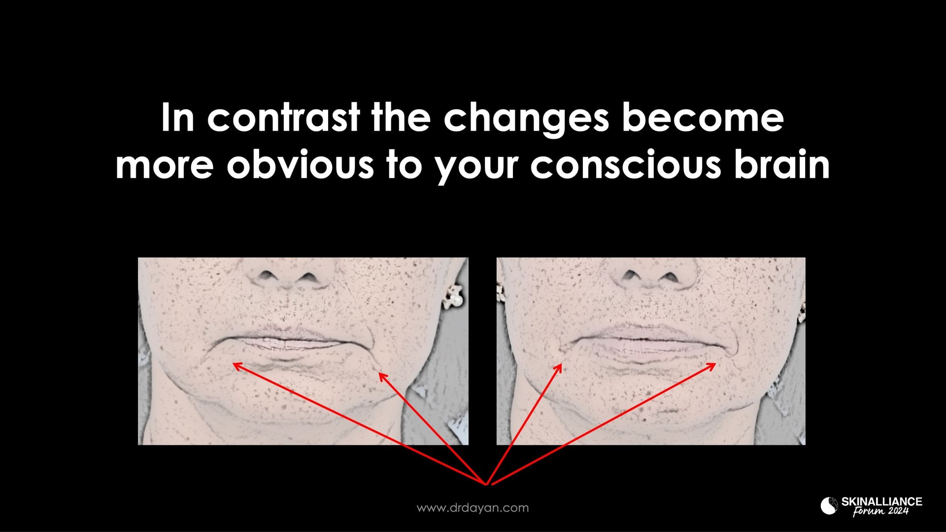 KEYNOTE: What is Beauty? Defining an enigma in the scientific age