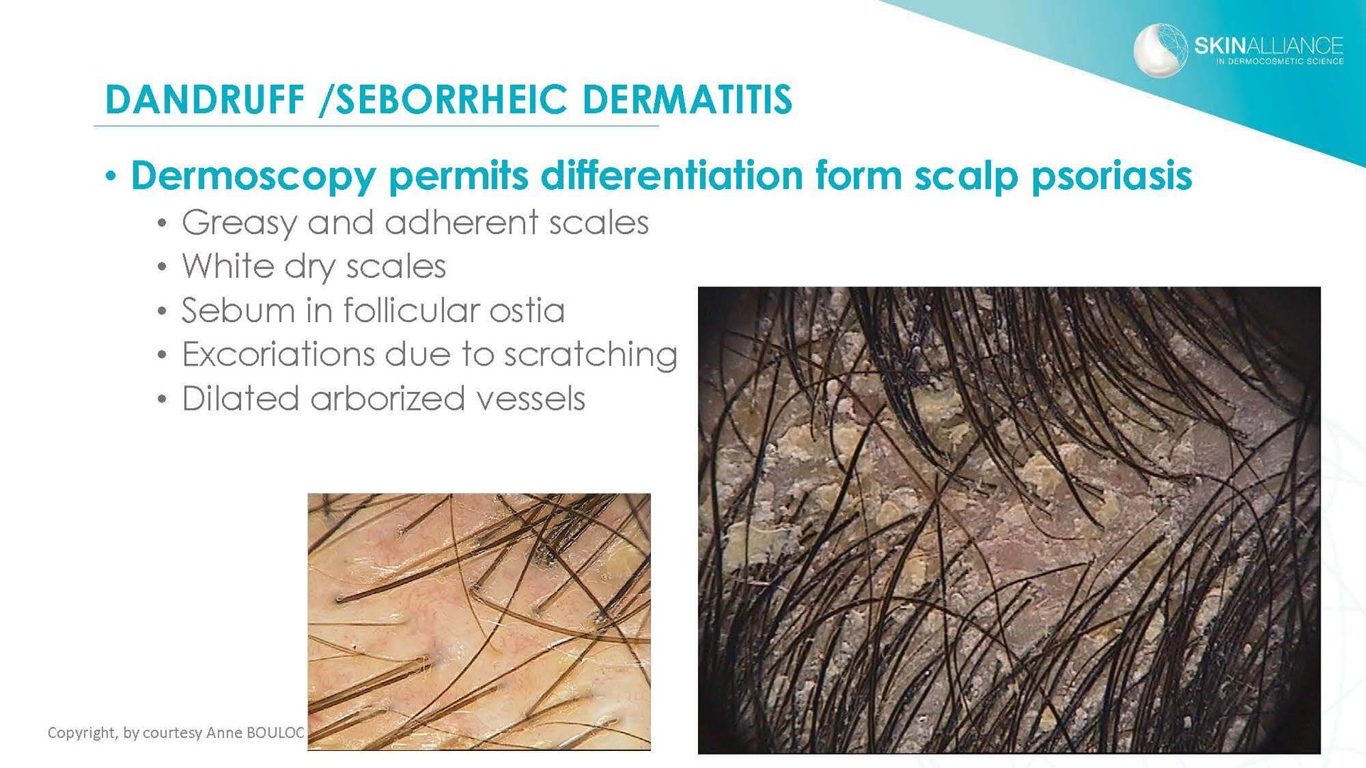 J1 Anne Bouloc - Cosmetics and Hair Care Scalp and Dandruff_Page_04