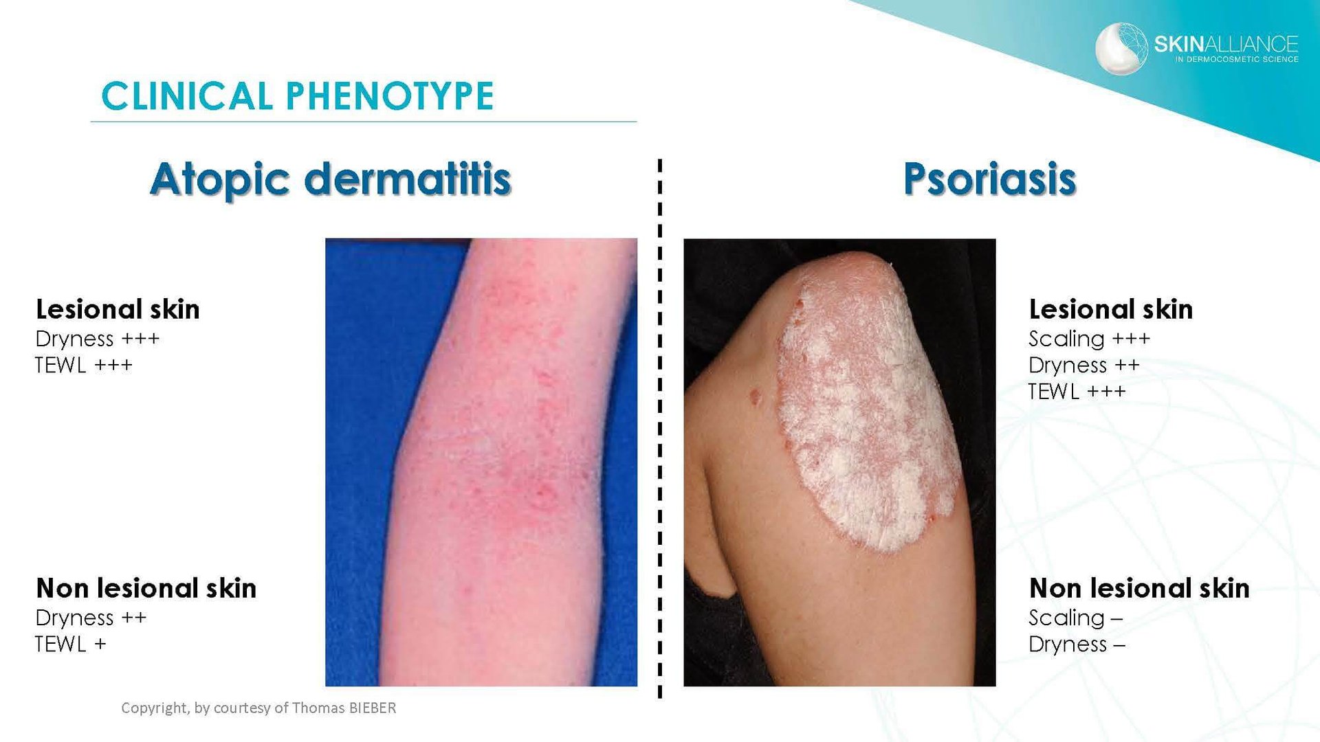 J2 Thomas Bieber - Cosmetics in Inflammatory Skin Diseases_Page_02