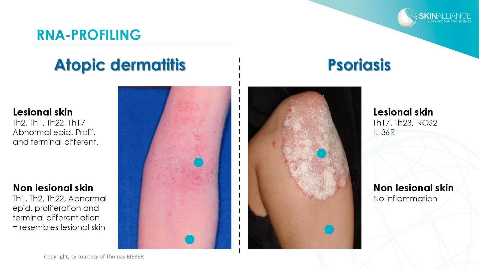 J2 Thomas Bieber - Cosmetics in Inflammatory Skin Diseases_Page_03