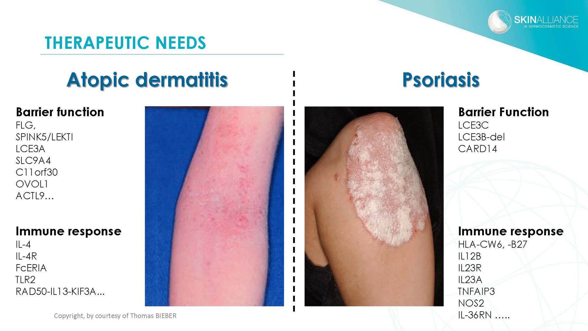 J2 Thomas Bieber - Cosmetics in Inflammatory Skin Diseases_Page_04