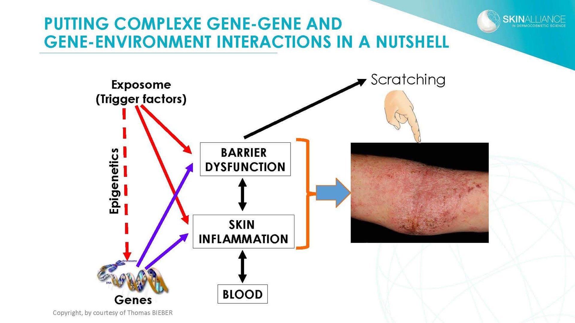 J2 Thomas Bieber - Cosmetics in Inflammatory Skin Diseases_Page_15