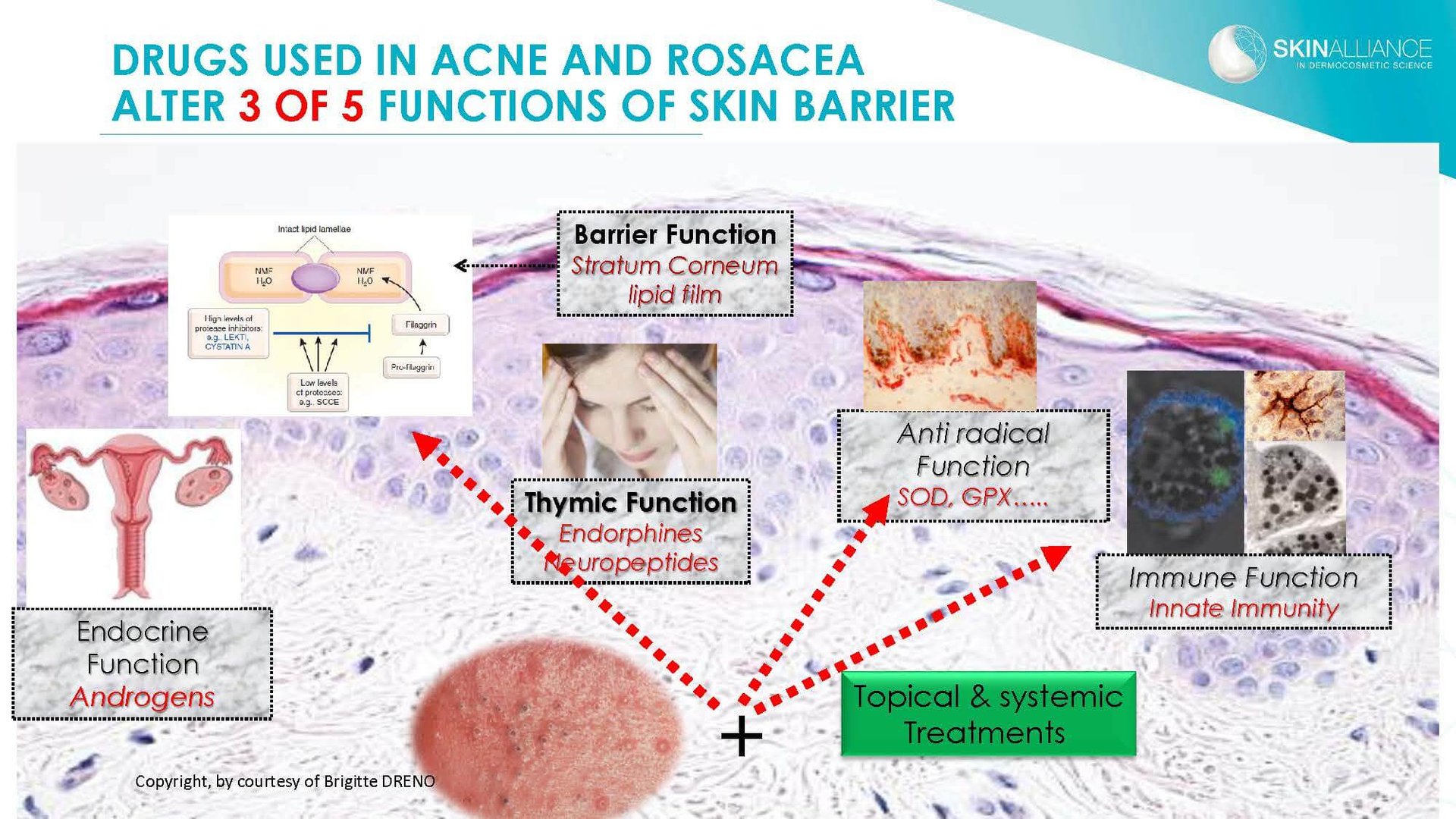 Dermocosmetics in Skin Acne and Rosacea Friend or Enemy_Page_06