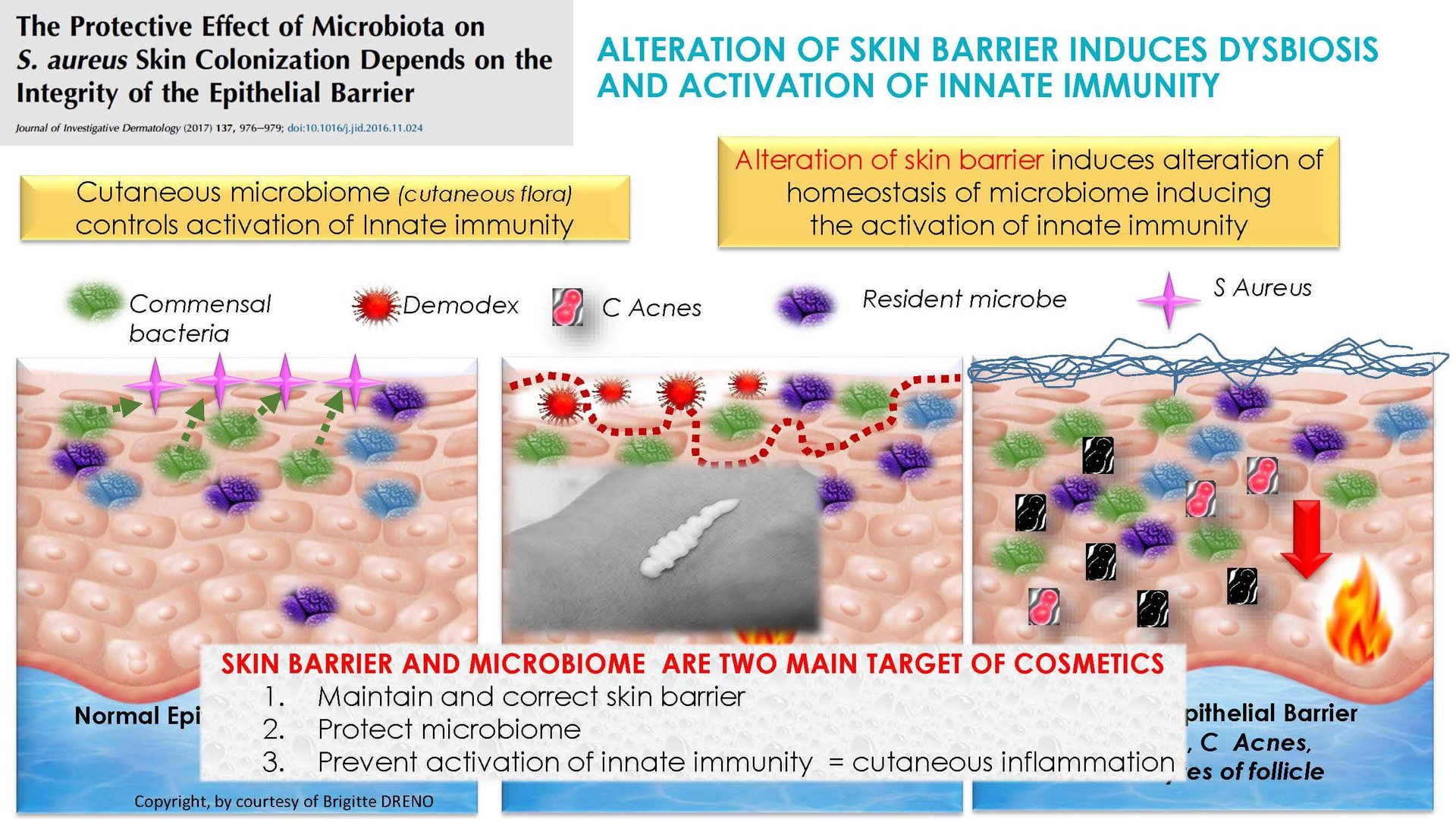 Dermocosmetics in Skin Acne and Rosacea Friend or Enemy_Page_07