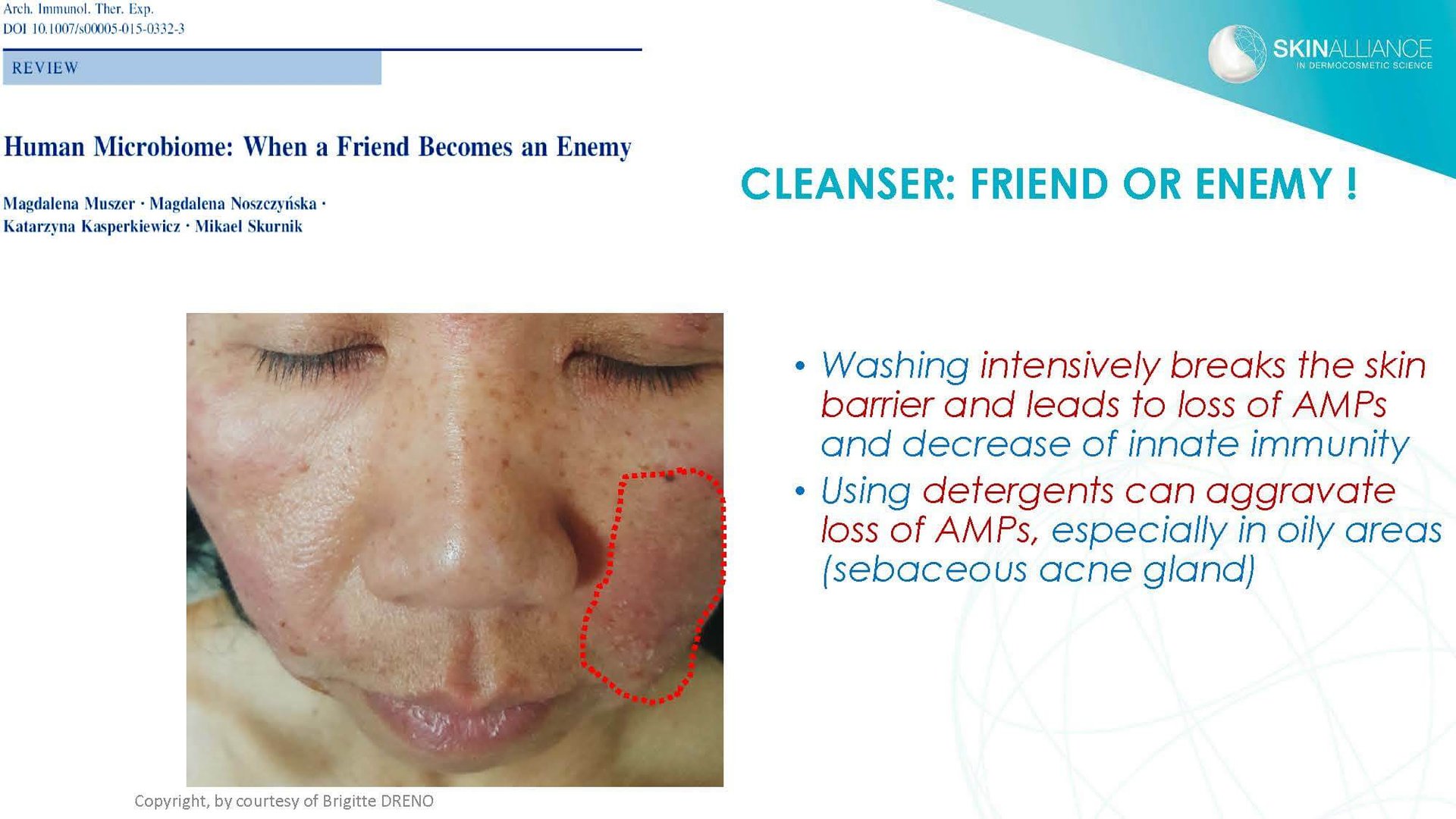 Dermocosmetics in Skin Acne and Rosacea Friend or Enemy_Page_18