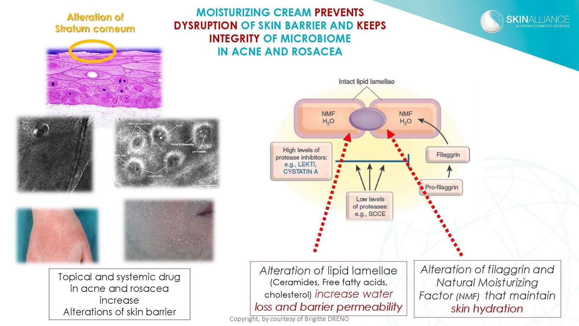 Dermocosmetics in Skin Acne and Rosacea Friend or Enemy_Page_19